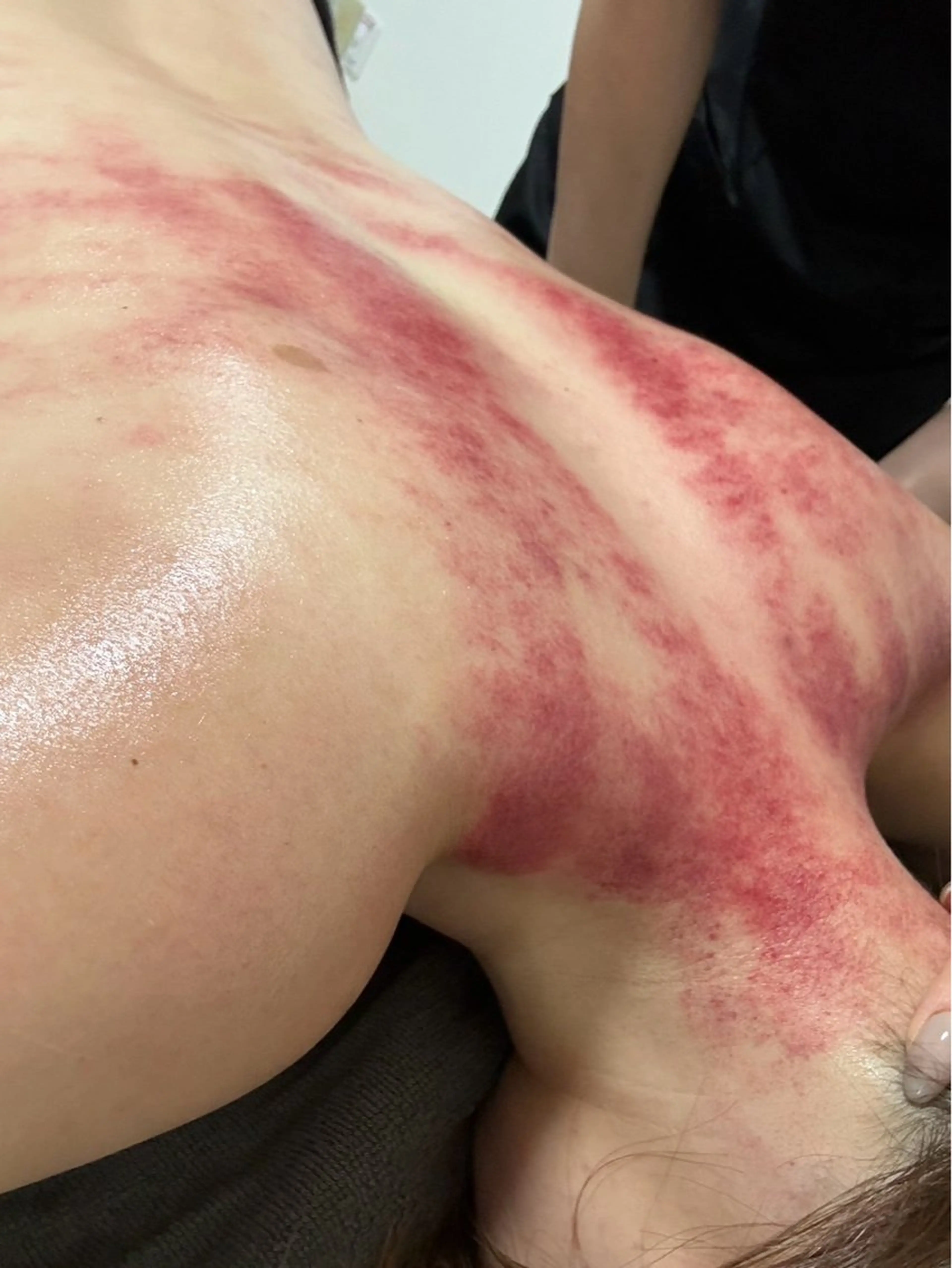 肩こりメインの写真