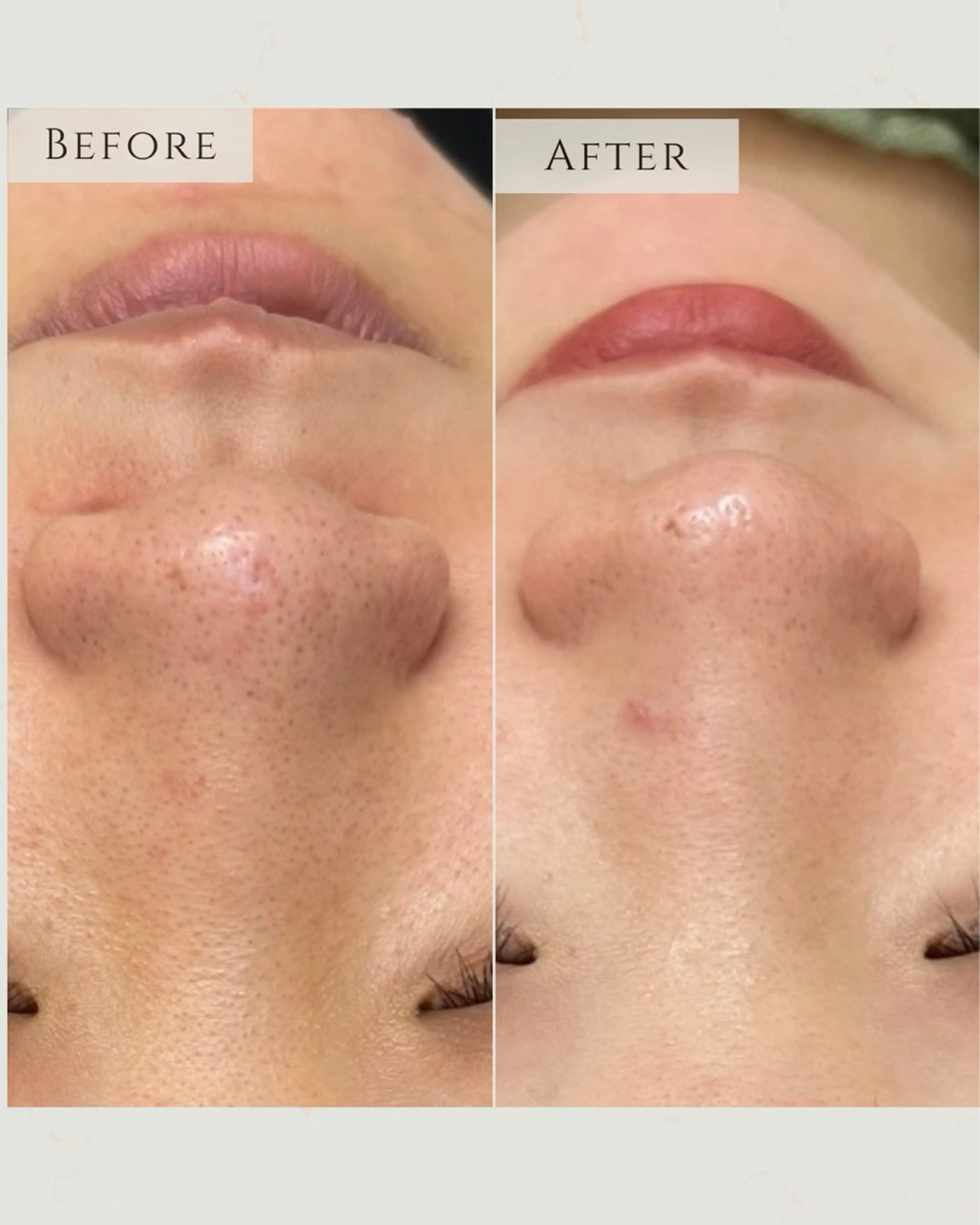 エステ 稲垣 優のエステ・リラクイメージ