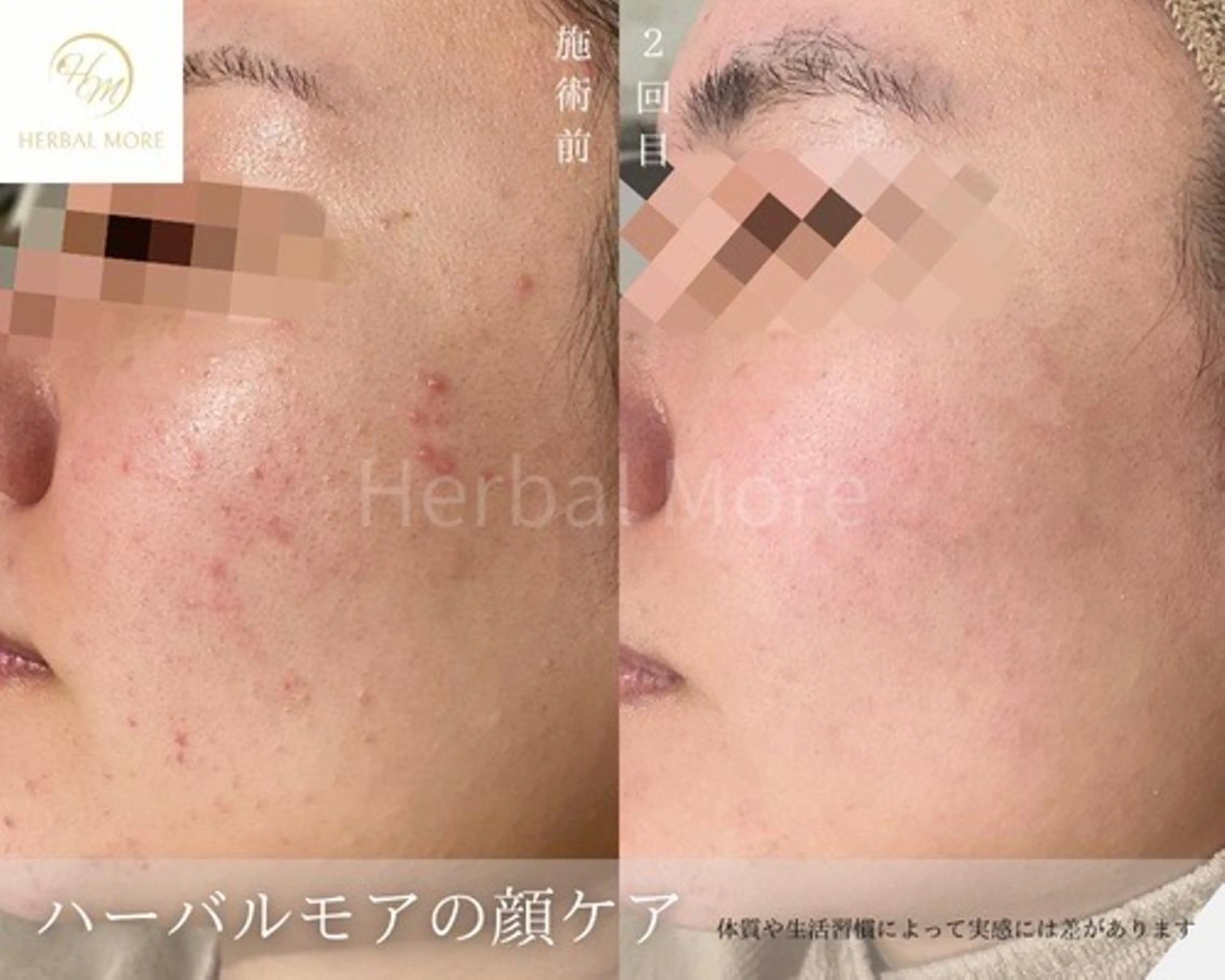 エステ リラク 脱毛・眉毛・フェイス サロンN久留米店の眉毛・アイブロウイメージ