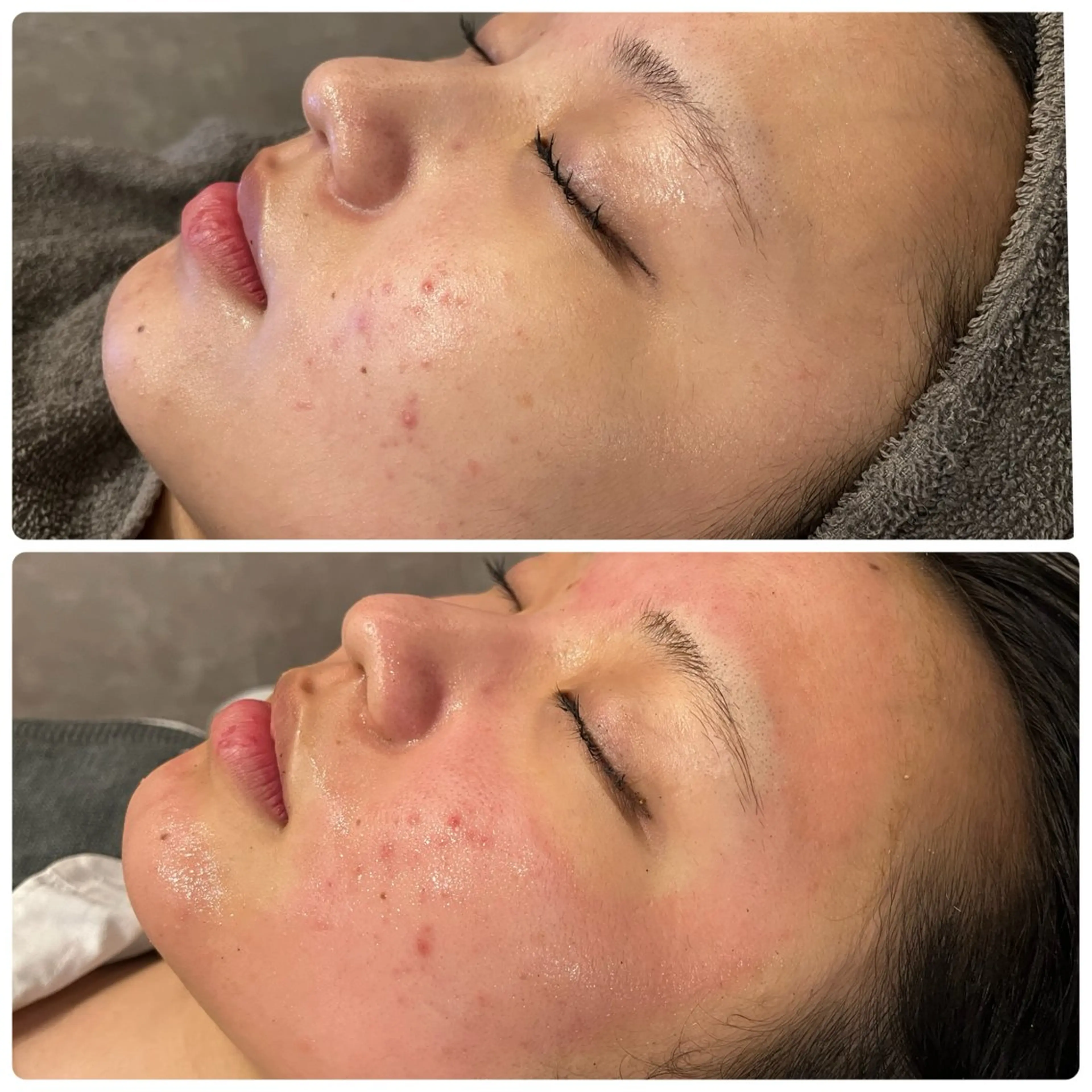 脱毛 yellow.所属・yellow💛【 脱毛&フェイシャル】のエステ・リラクイメージ