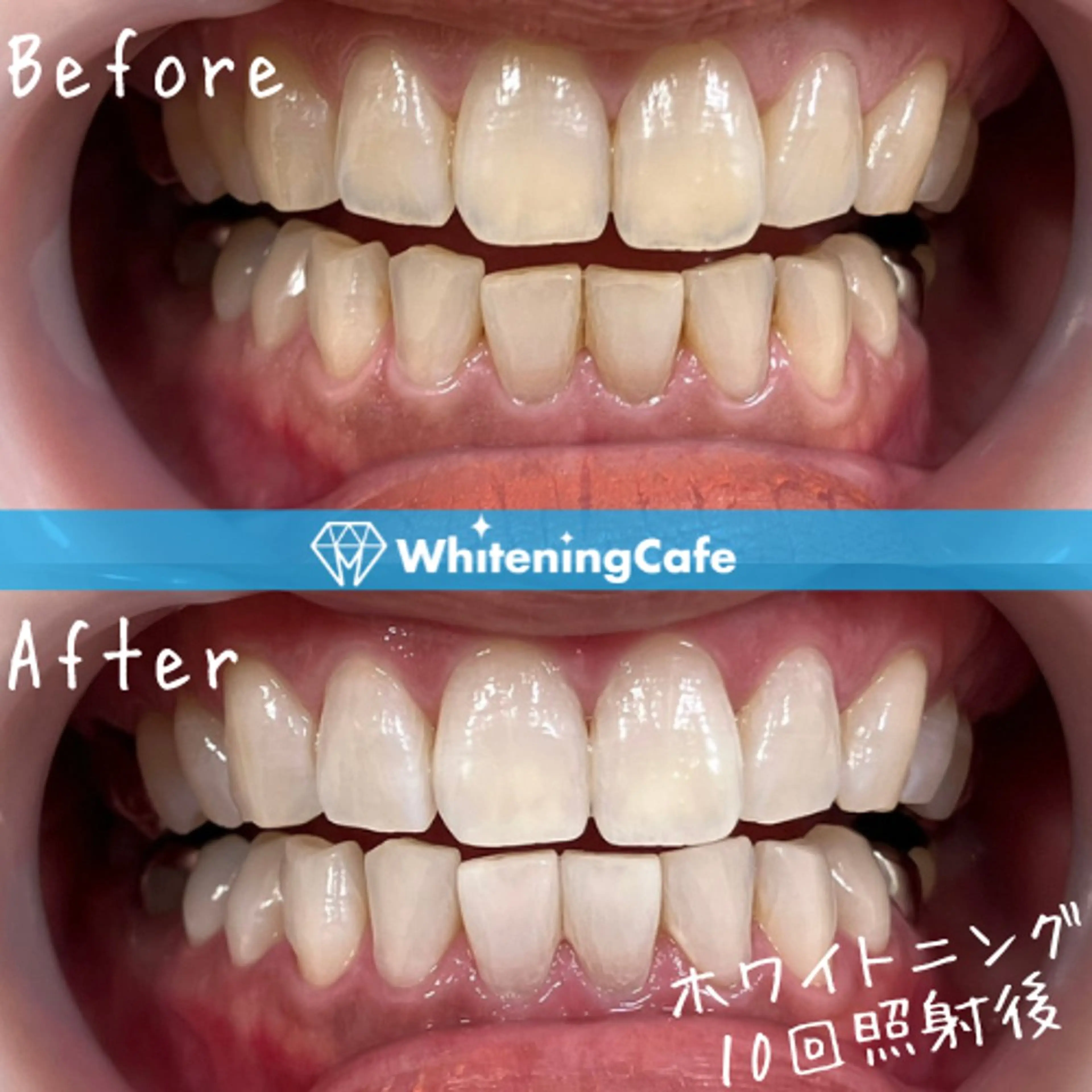 ホワイトニングカフェ徳島沖浜店所属・ホワイトニングカフェ 徳島沖浜店のエステ・リラクイメージ