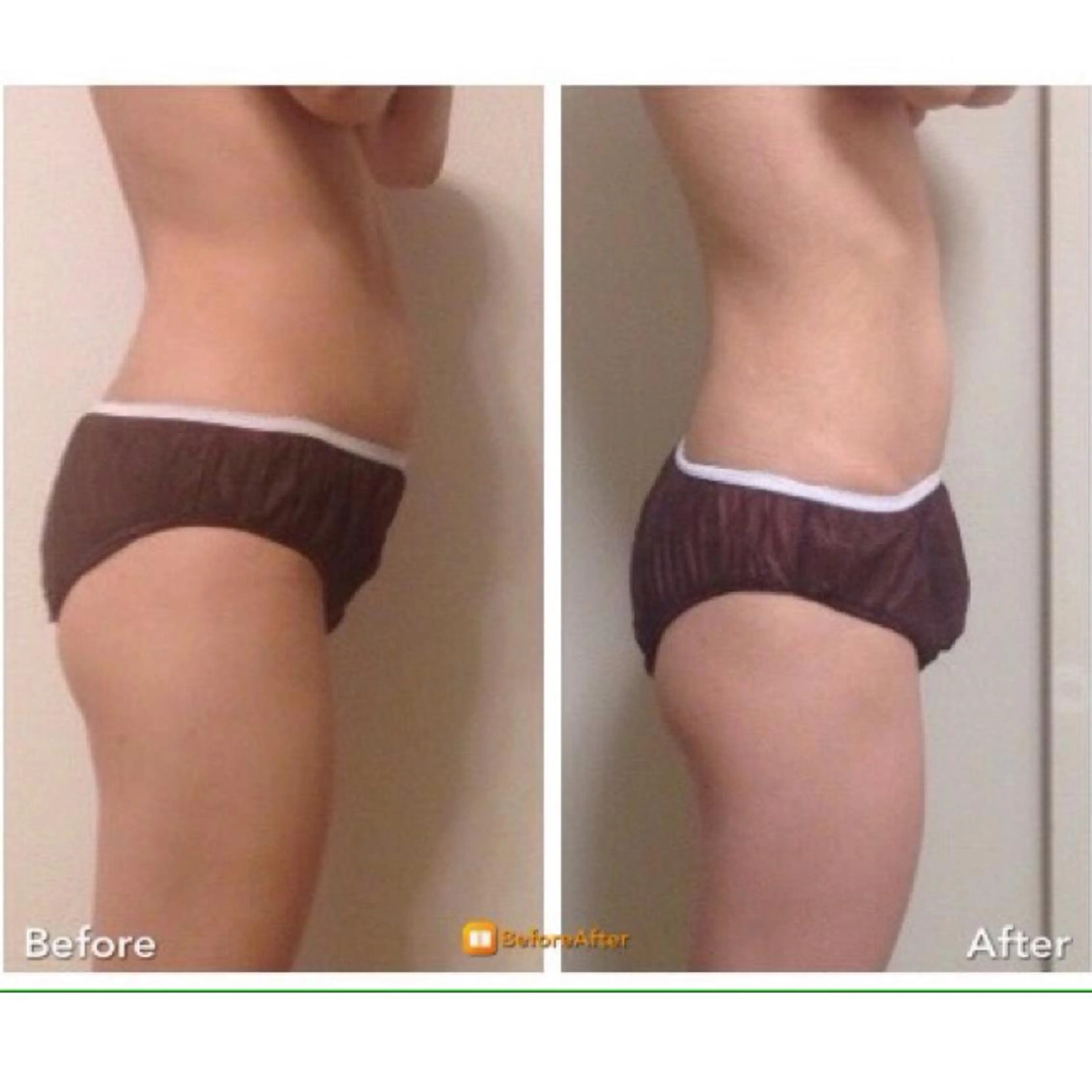 🌸人気No1🌸 スピード痩身♪劇的スリム★がっつり全身90分￥22000→￥8900の写真