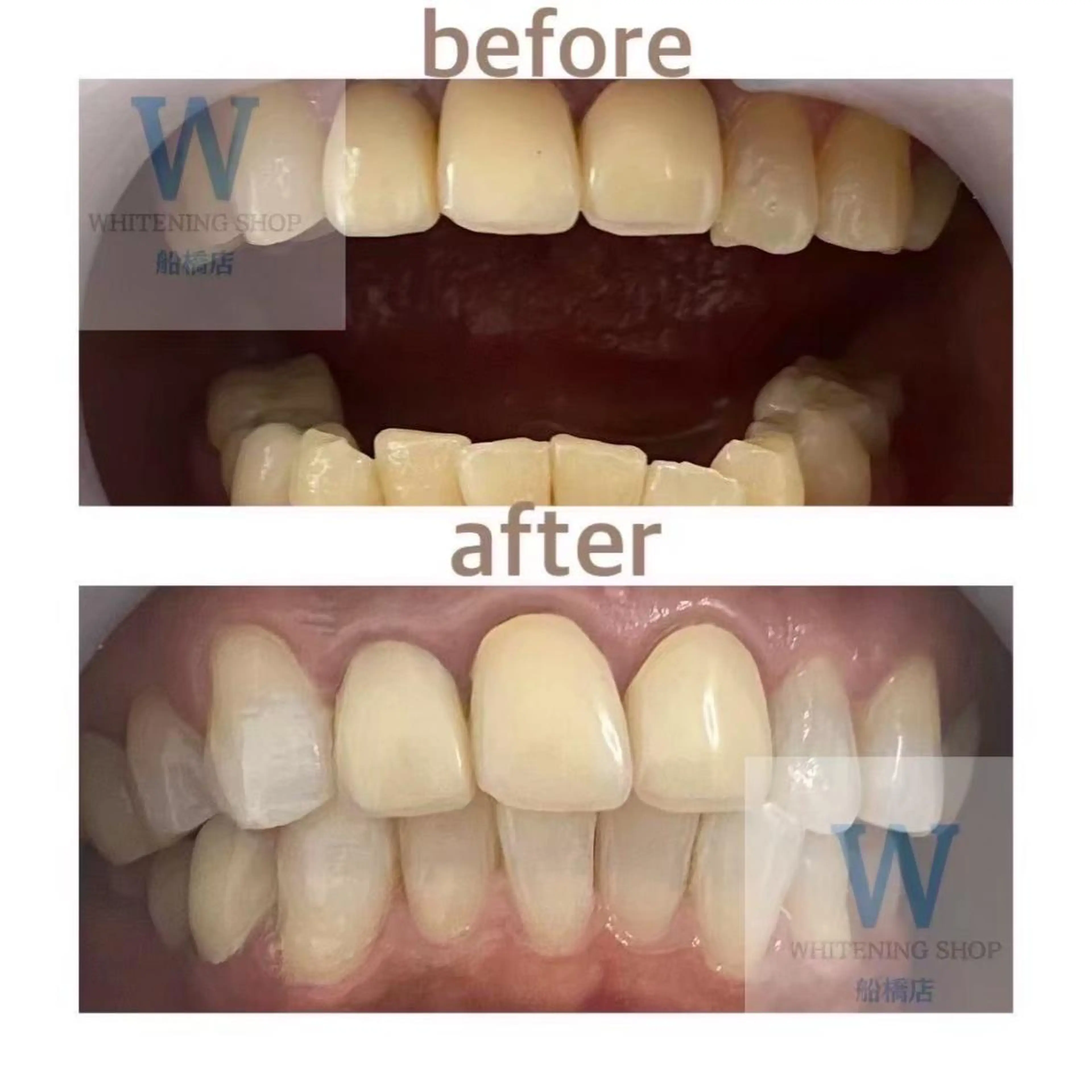 ホワイトニング ショップ船橋店🦷のエステ・リラクイメージ