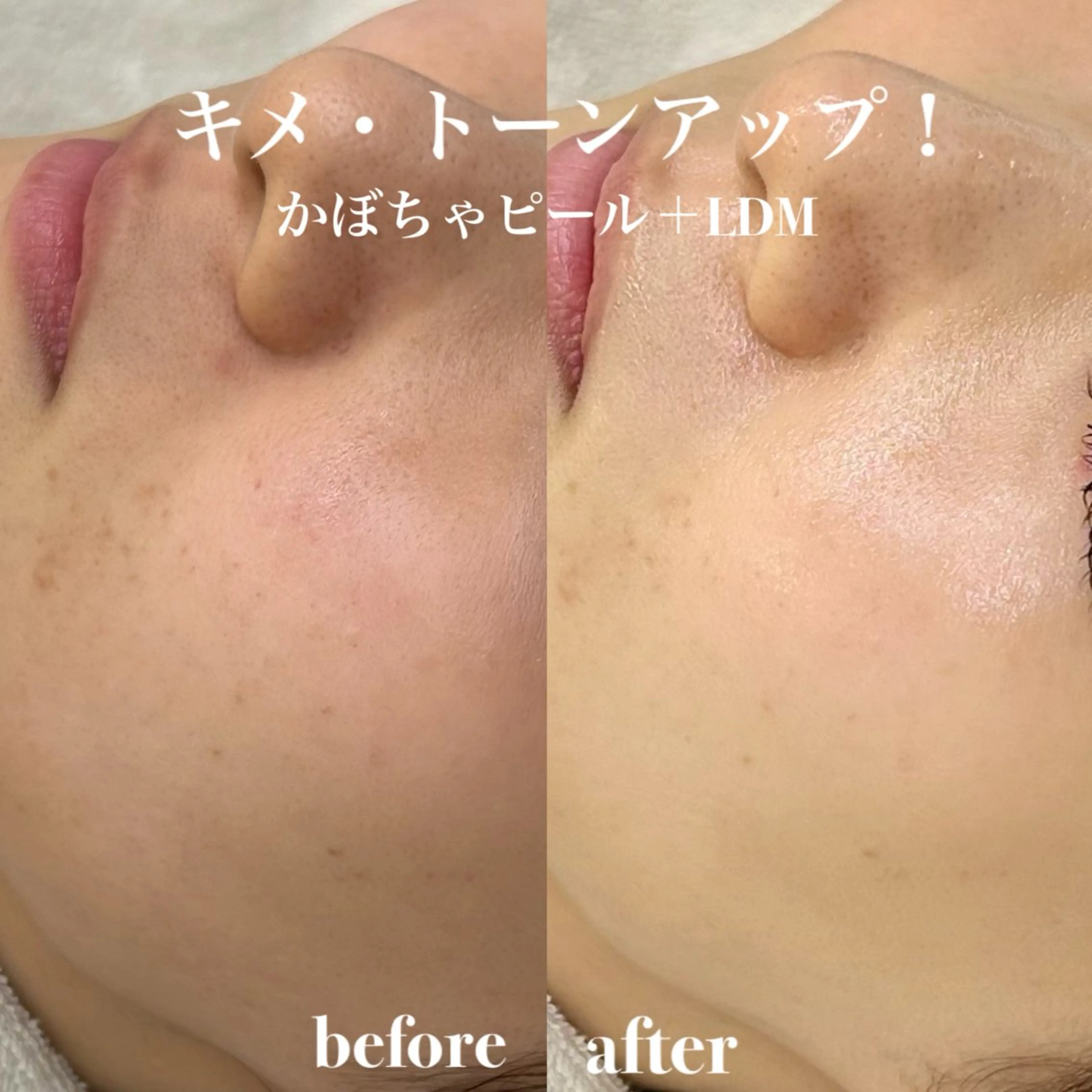 韓国肌管理&小顔 ＩＲＯＨＡのエステ・リラクイメージ