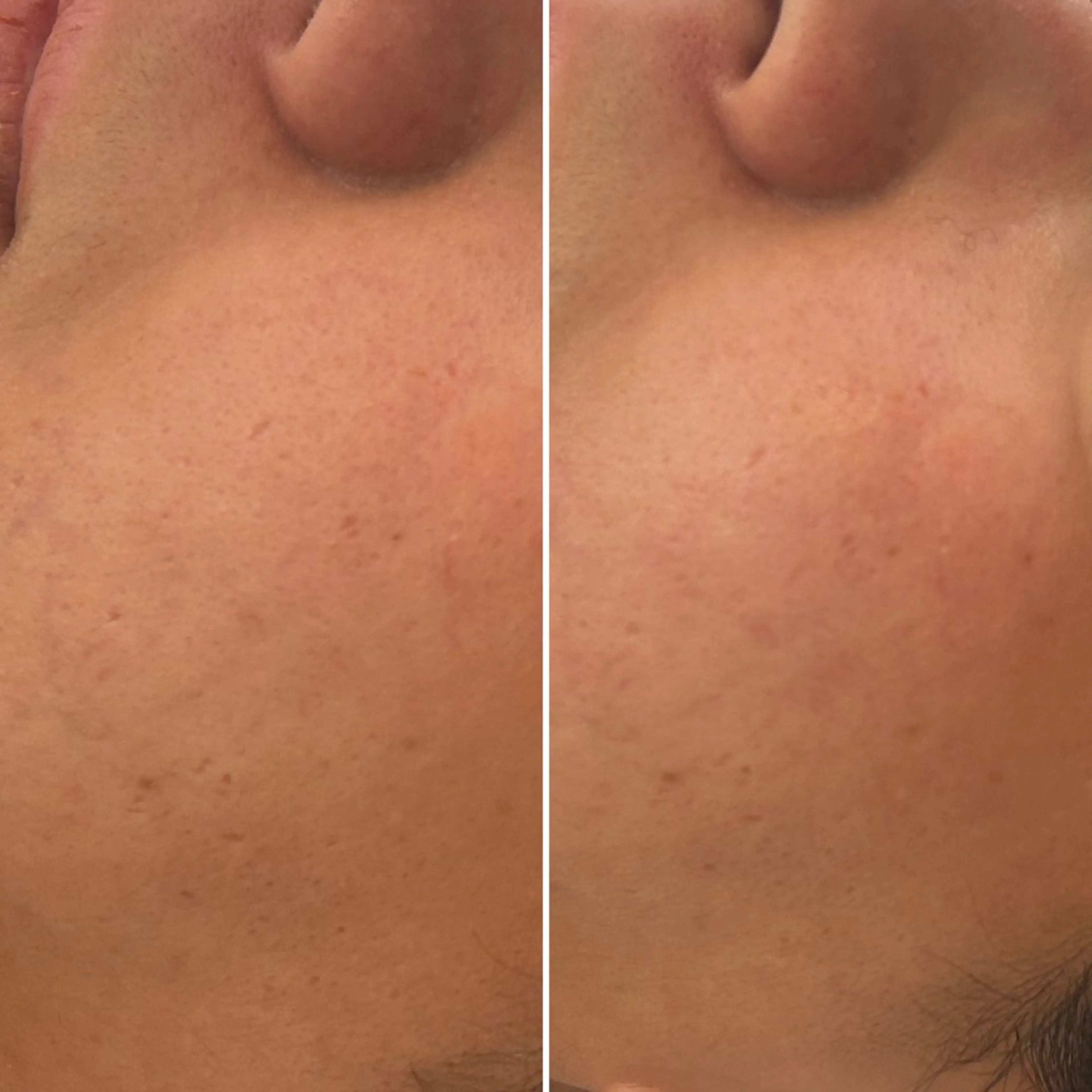 韓国🇰🇷価格 サロン_Nbibiの眉毛・アイブロウイメージ