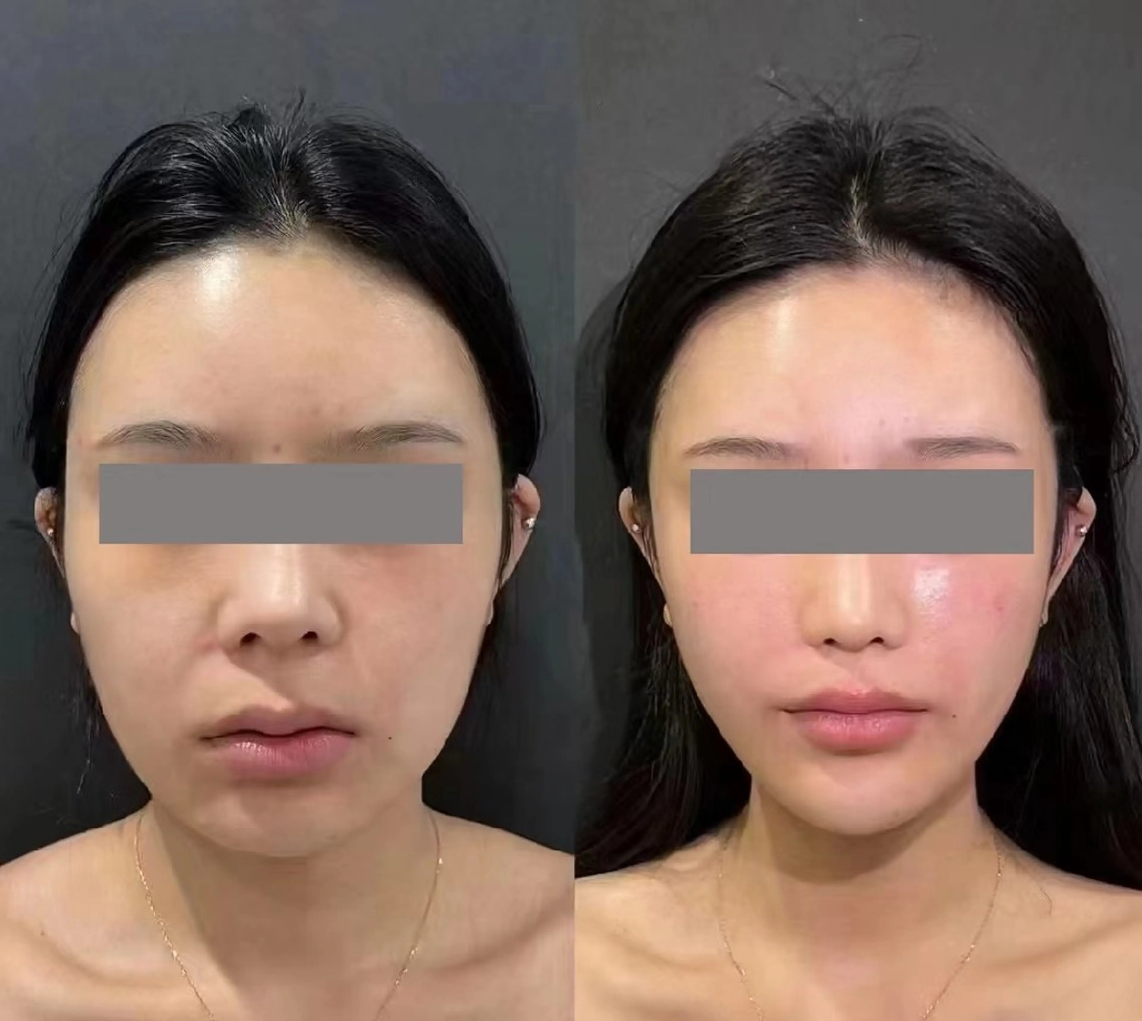 エステ aliaハイフ&水光ジェットサロン所属・aliaハーブ水光店 エステティシャン募集のエステ・リラクイメージ