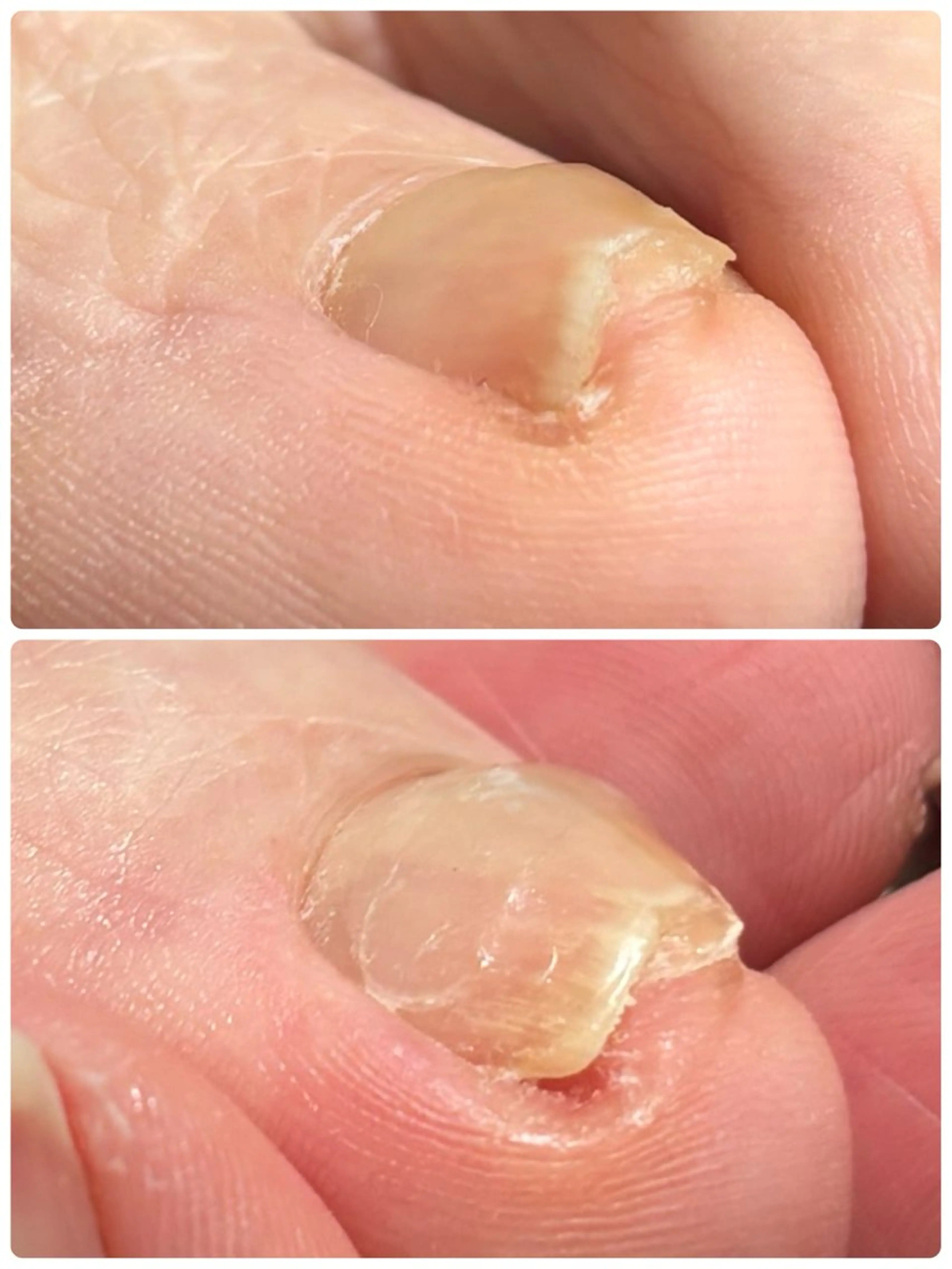 ネイル Alo.nail アロ•ネイルのネイルデザイン