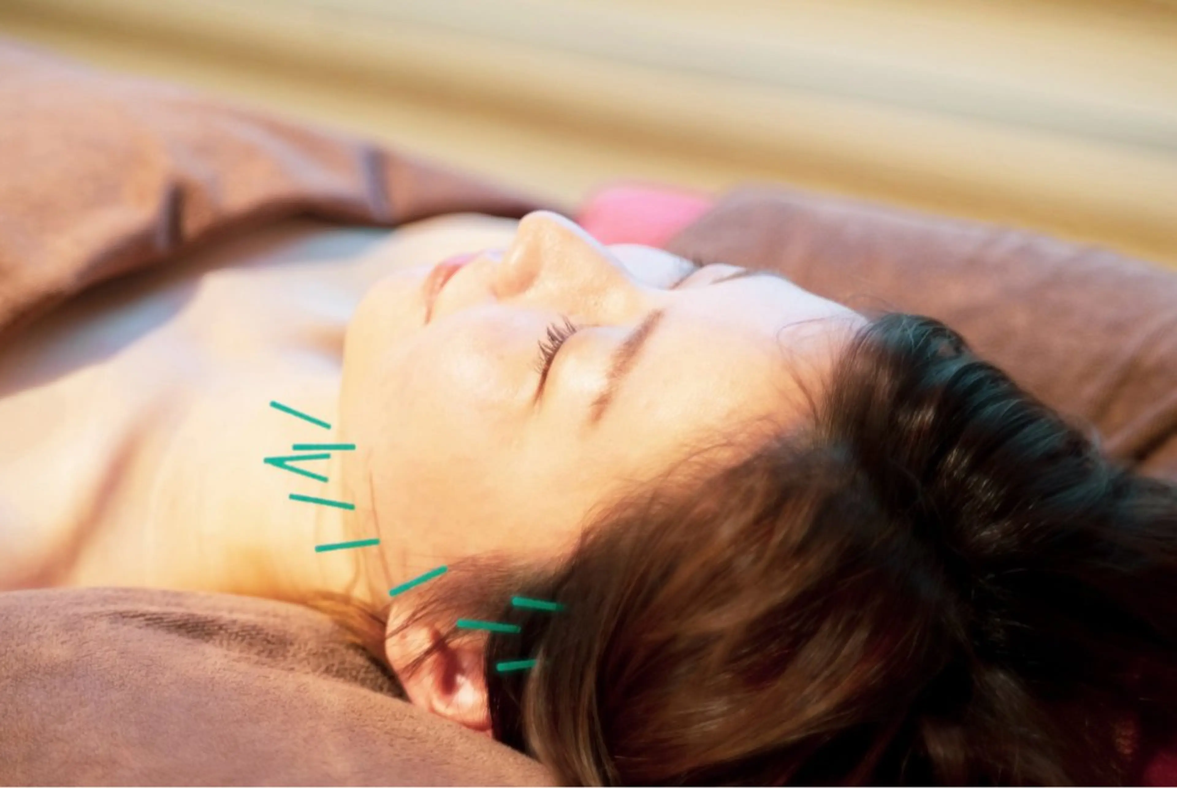 【都度】学生限定価格❗️オーダーメイドお悩み美容鍼コース🪡の写真