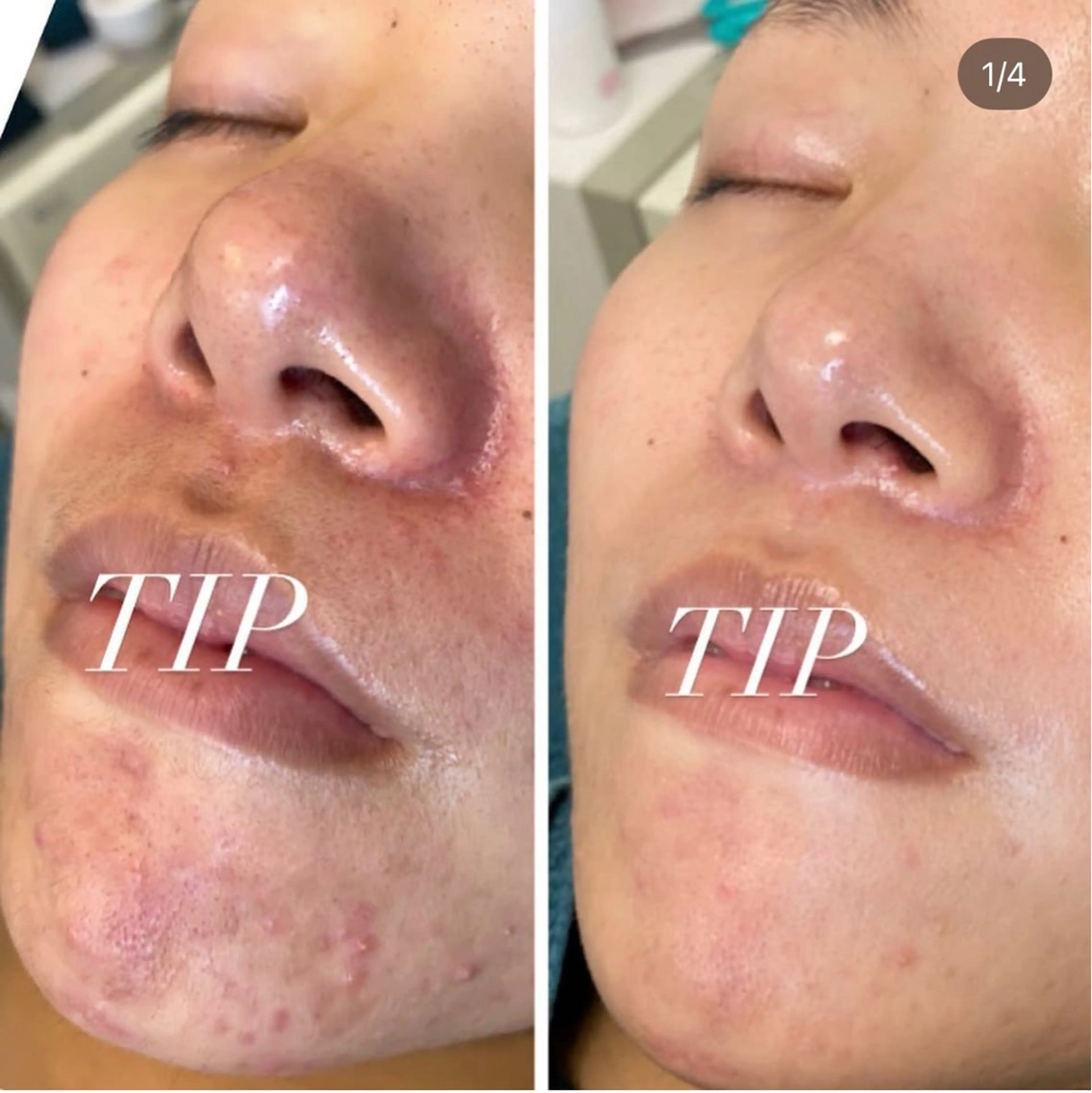 メンズ 山村 有花のエステ・リラクイメージ