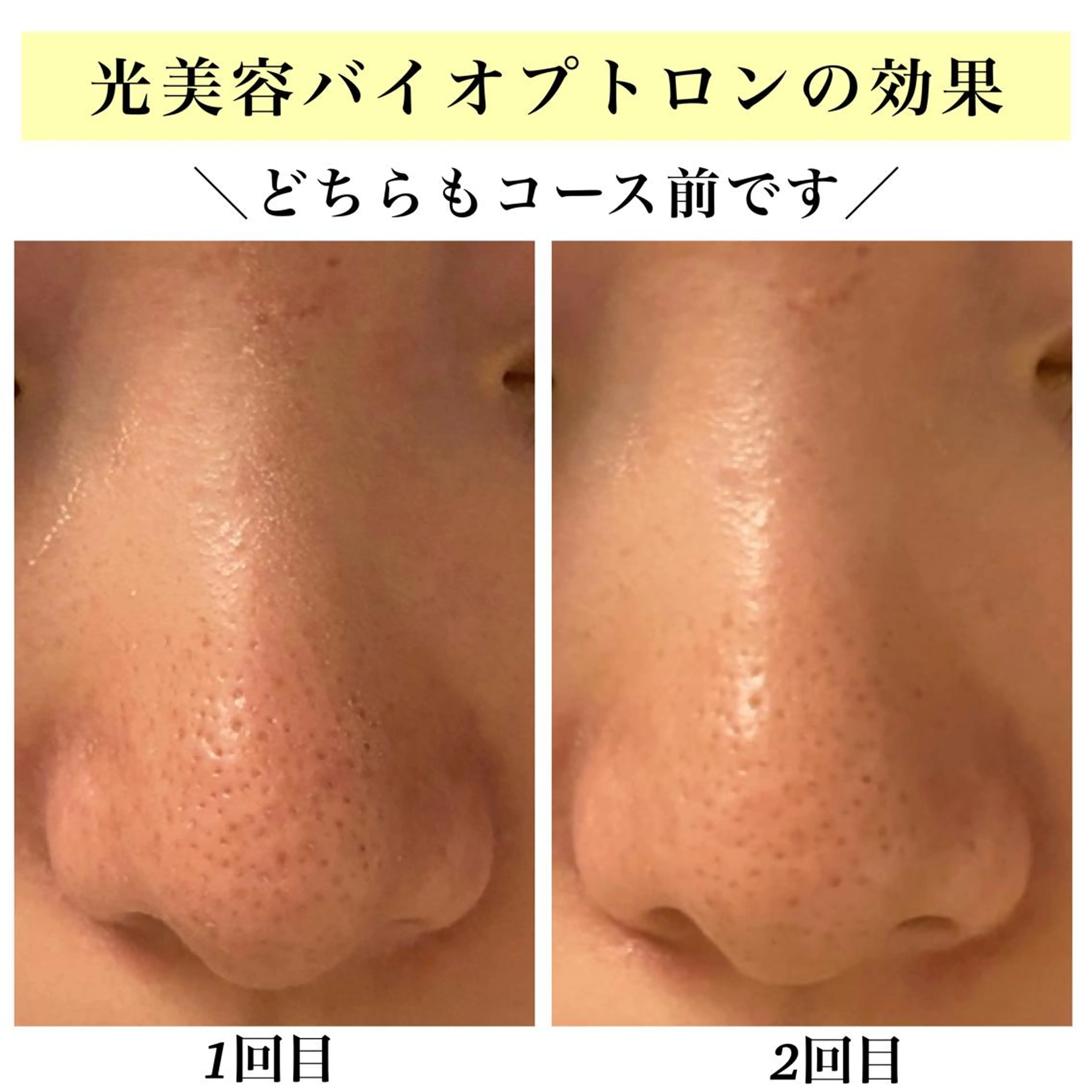 エステ リラク Bellesthe （ベルエステ）のエステ・リラクイメージ