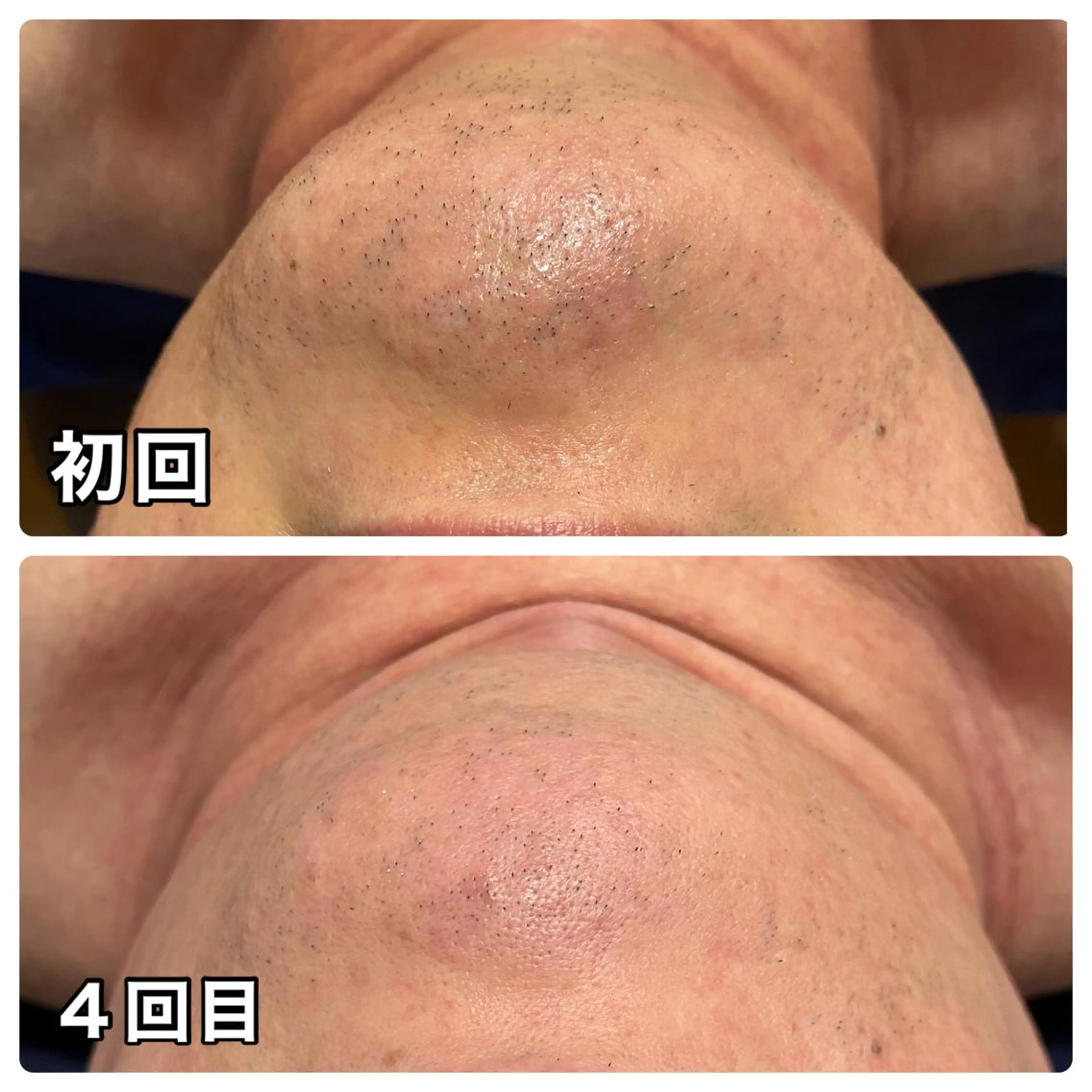 🌴Beauty Salon LANAのエステ・リラクイメージ