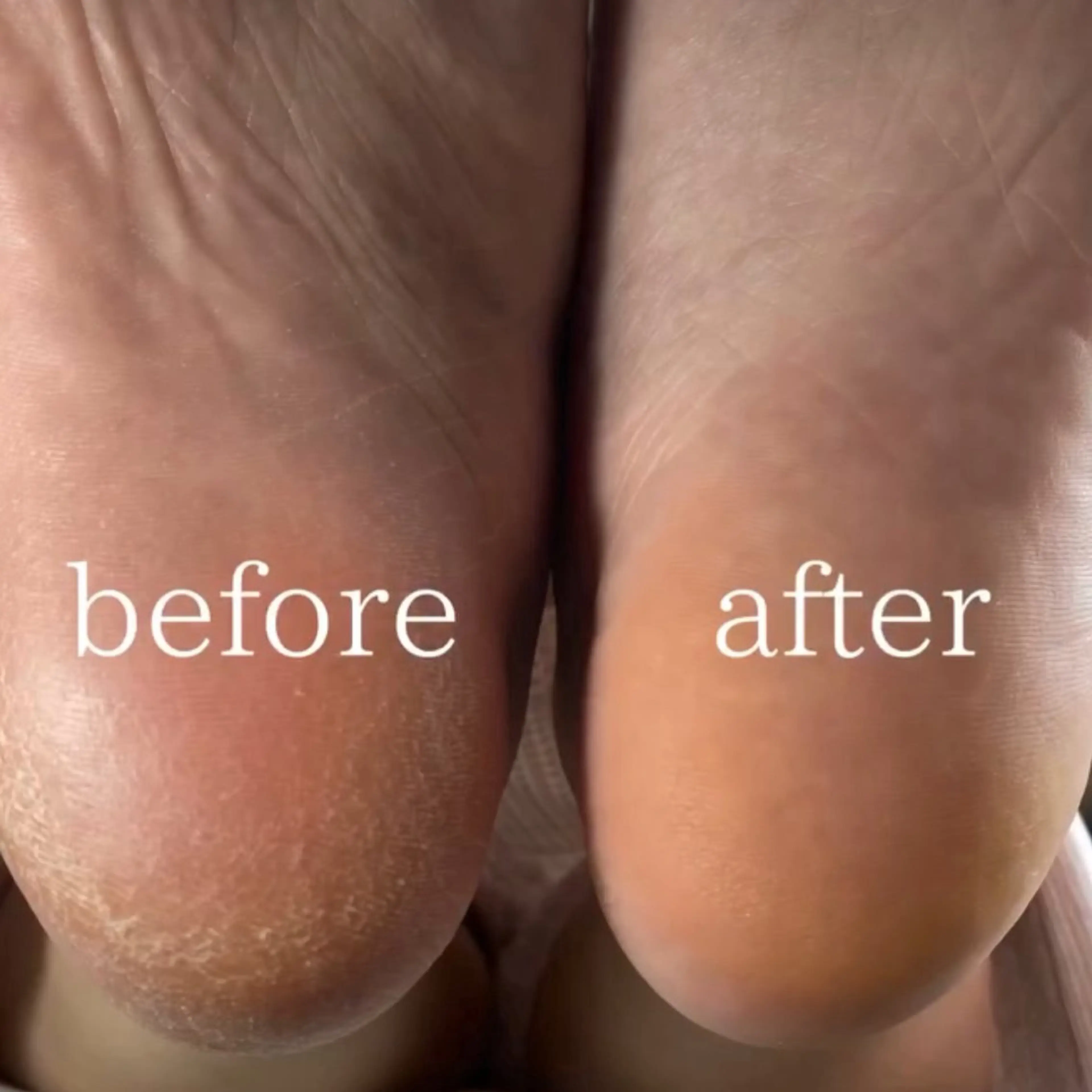 【Foot】艶足デザインケアコース¥8000〜の写真