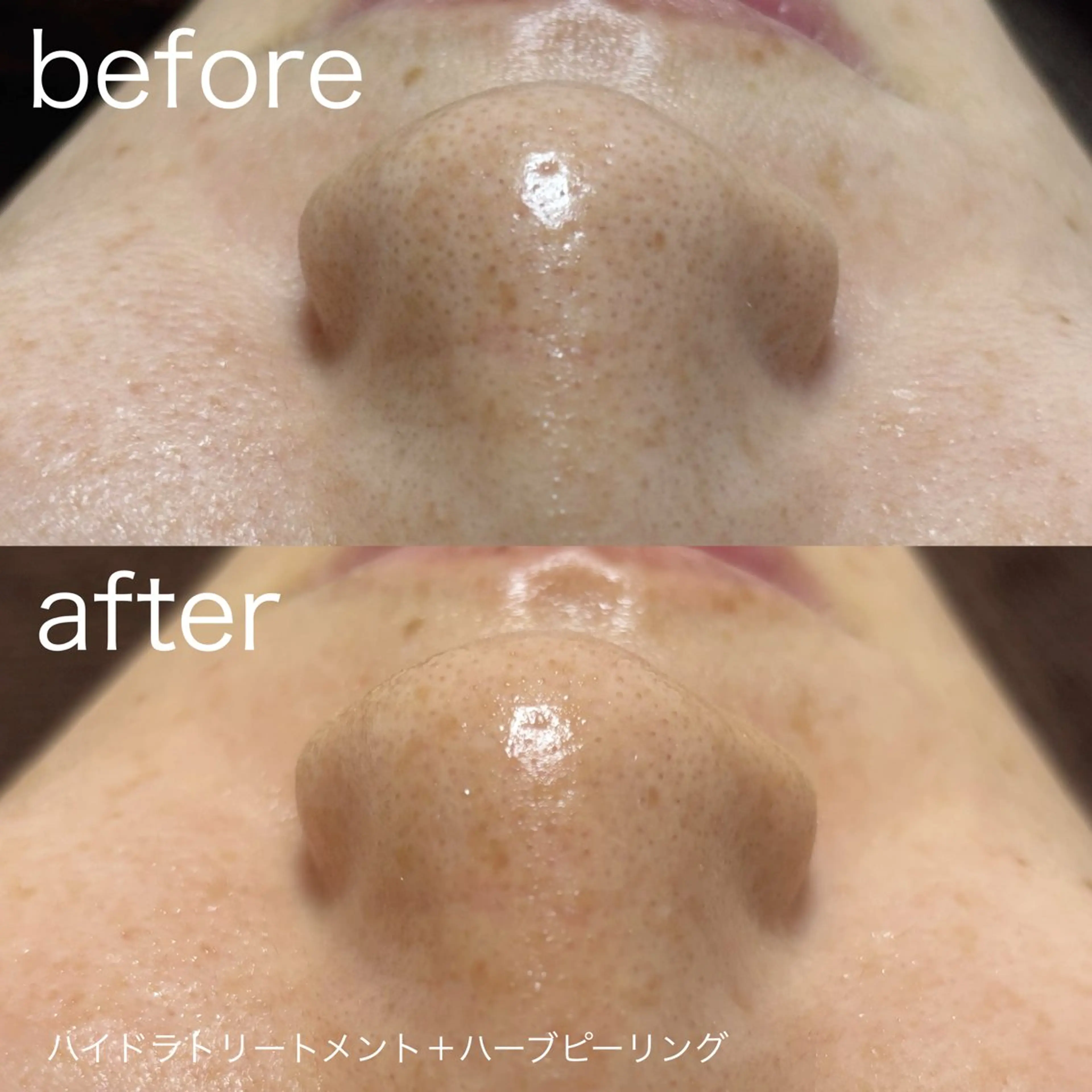 lulularico Yuのエステ・リラクイメージ