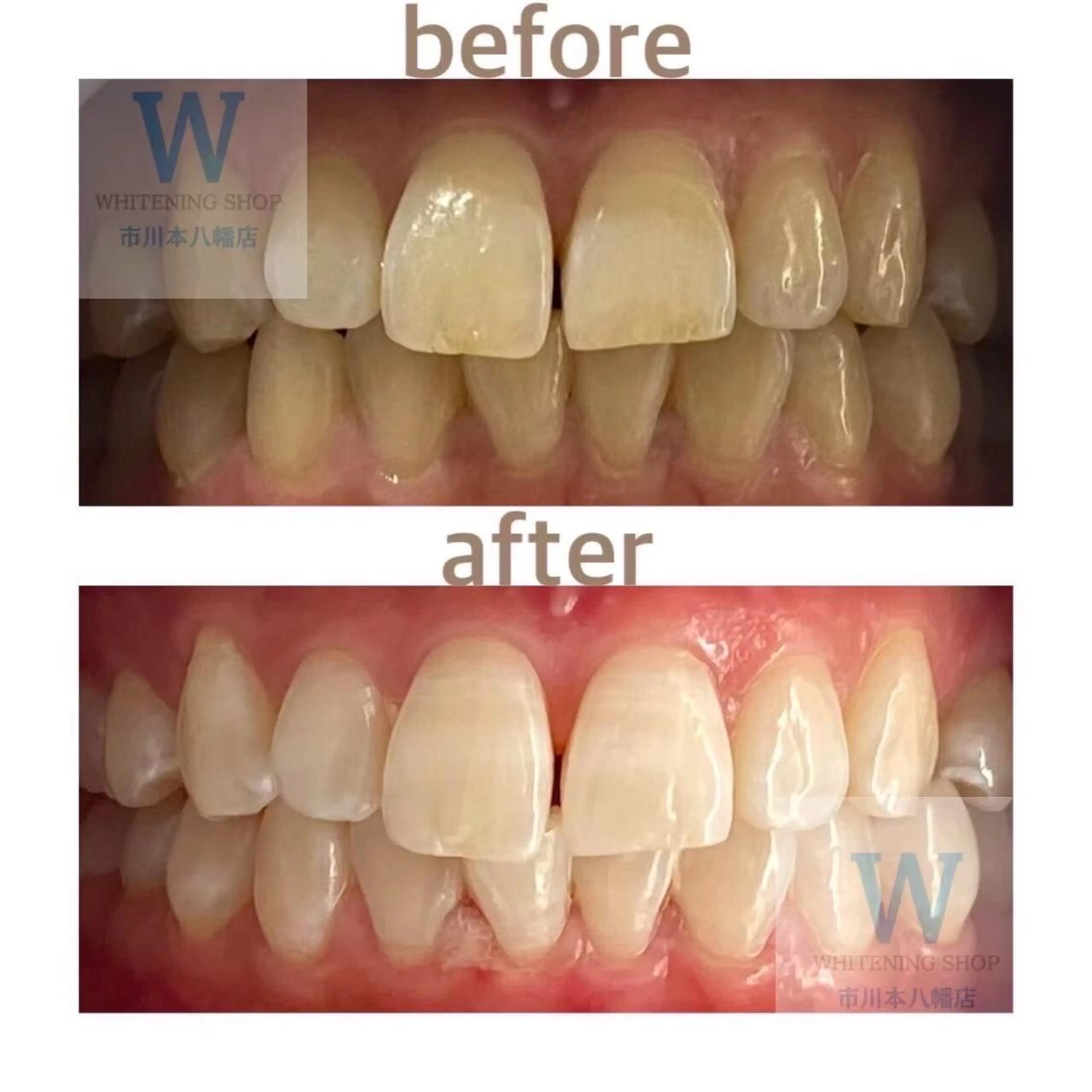 ホワイトニング ショップ本八幡店のエステ・リラクイメージ