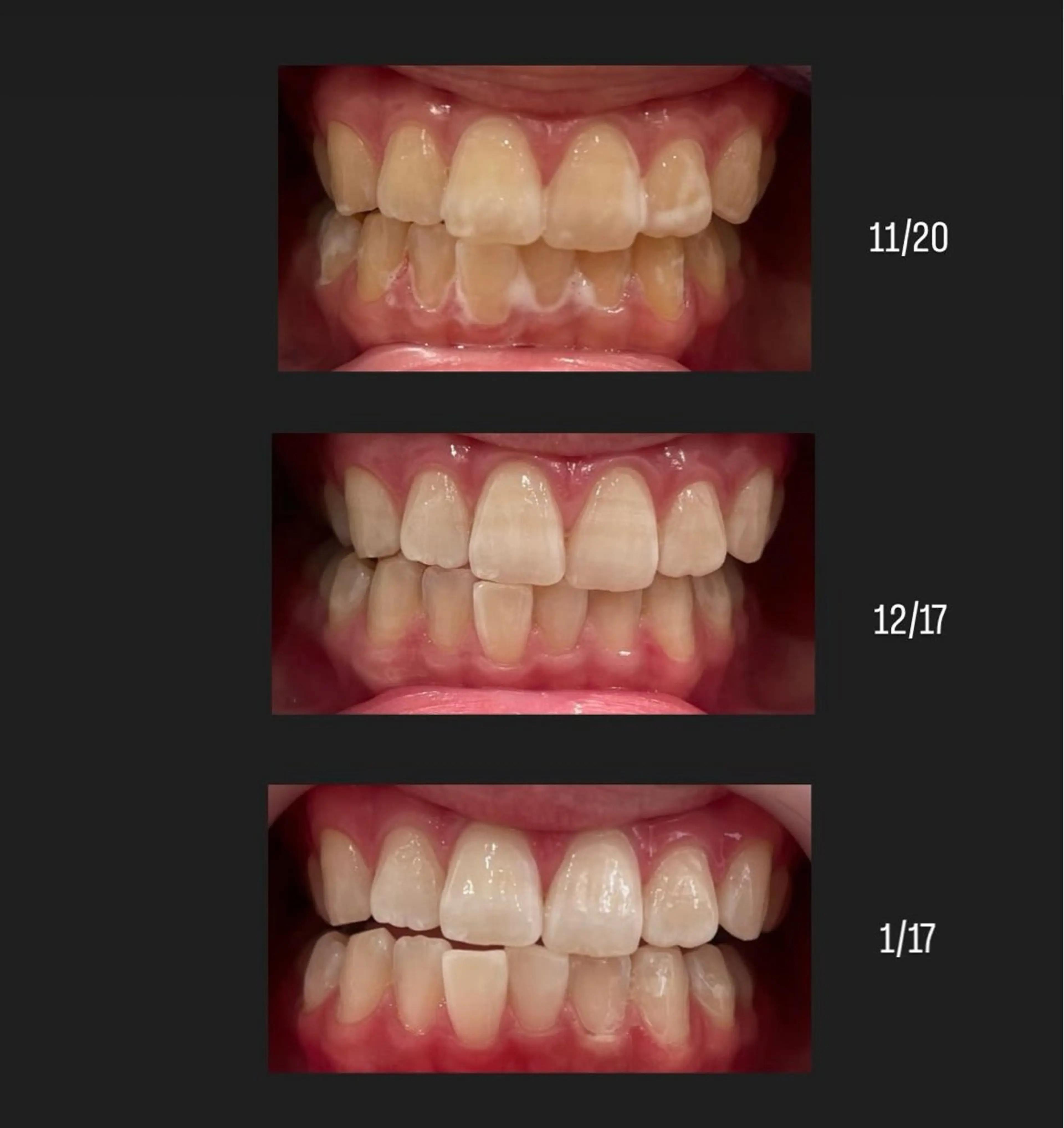 Kaula ホワイトニング🦷✨のエステ・リラクイメージ