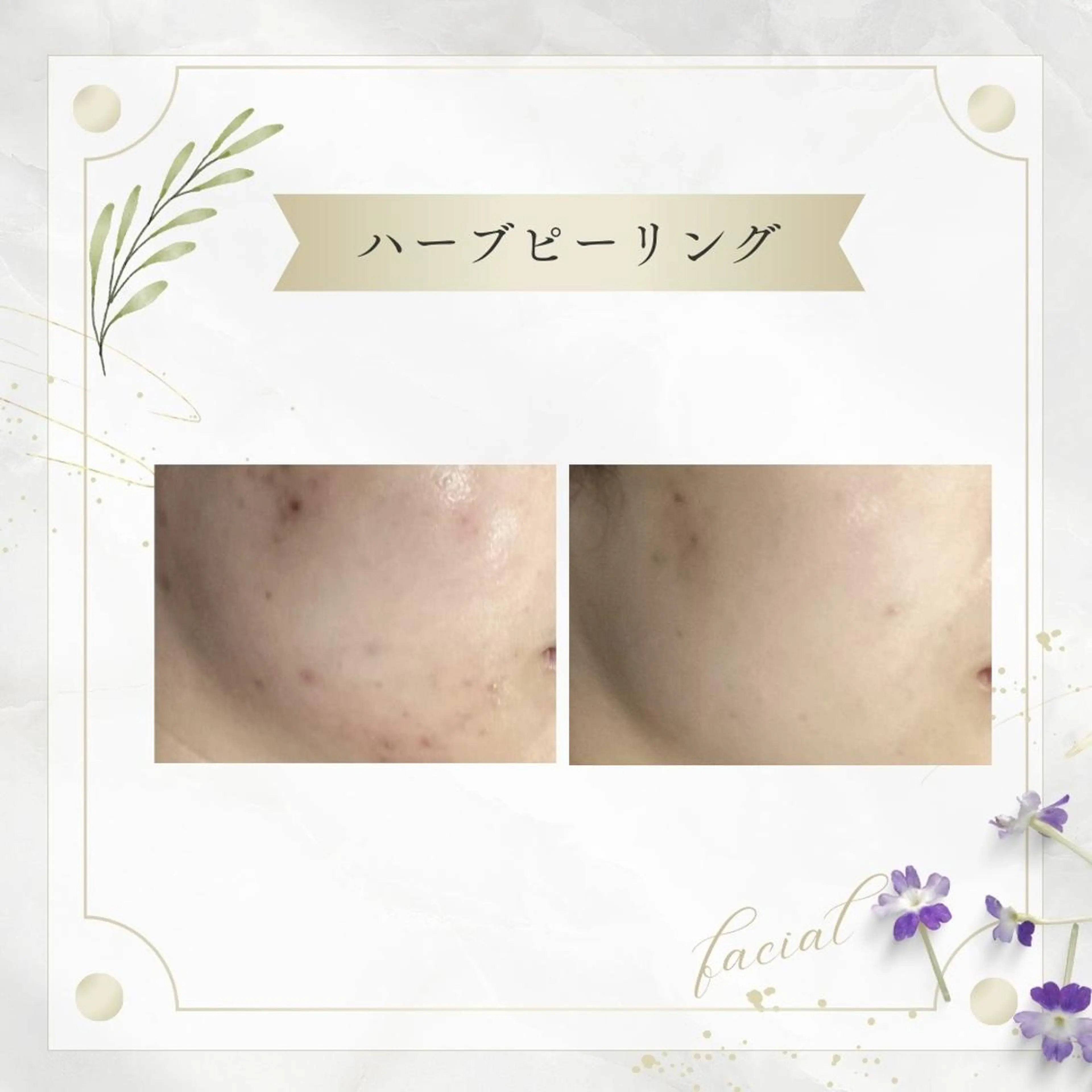 《 肌質×美肌 》 addissimoのエステ・リラクイメージ