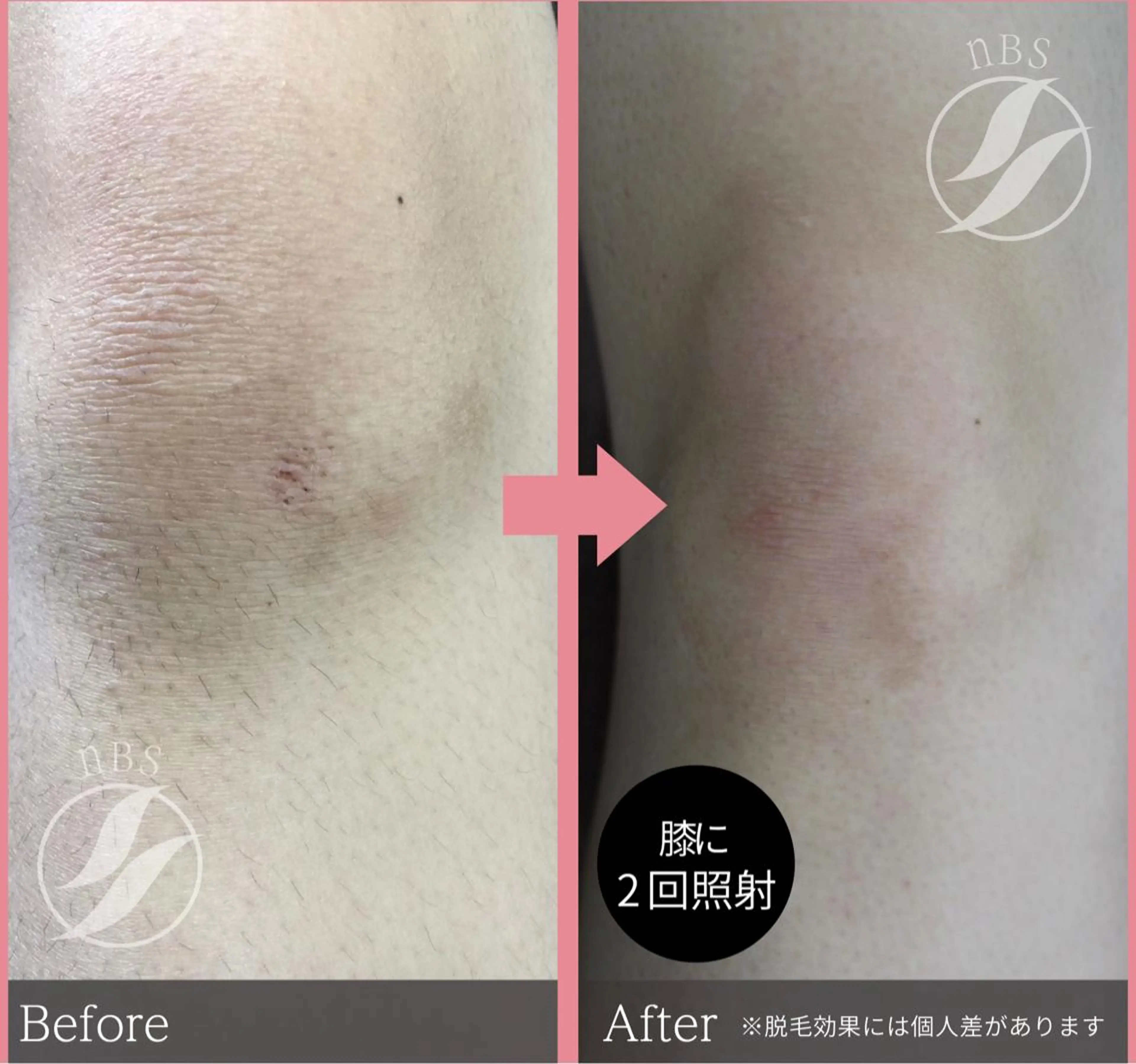 Shelly Graceのエステ・リラクイメージ