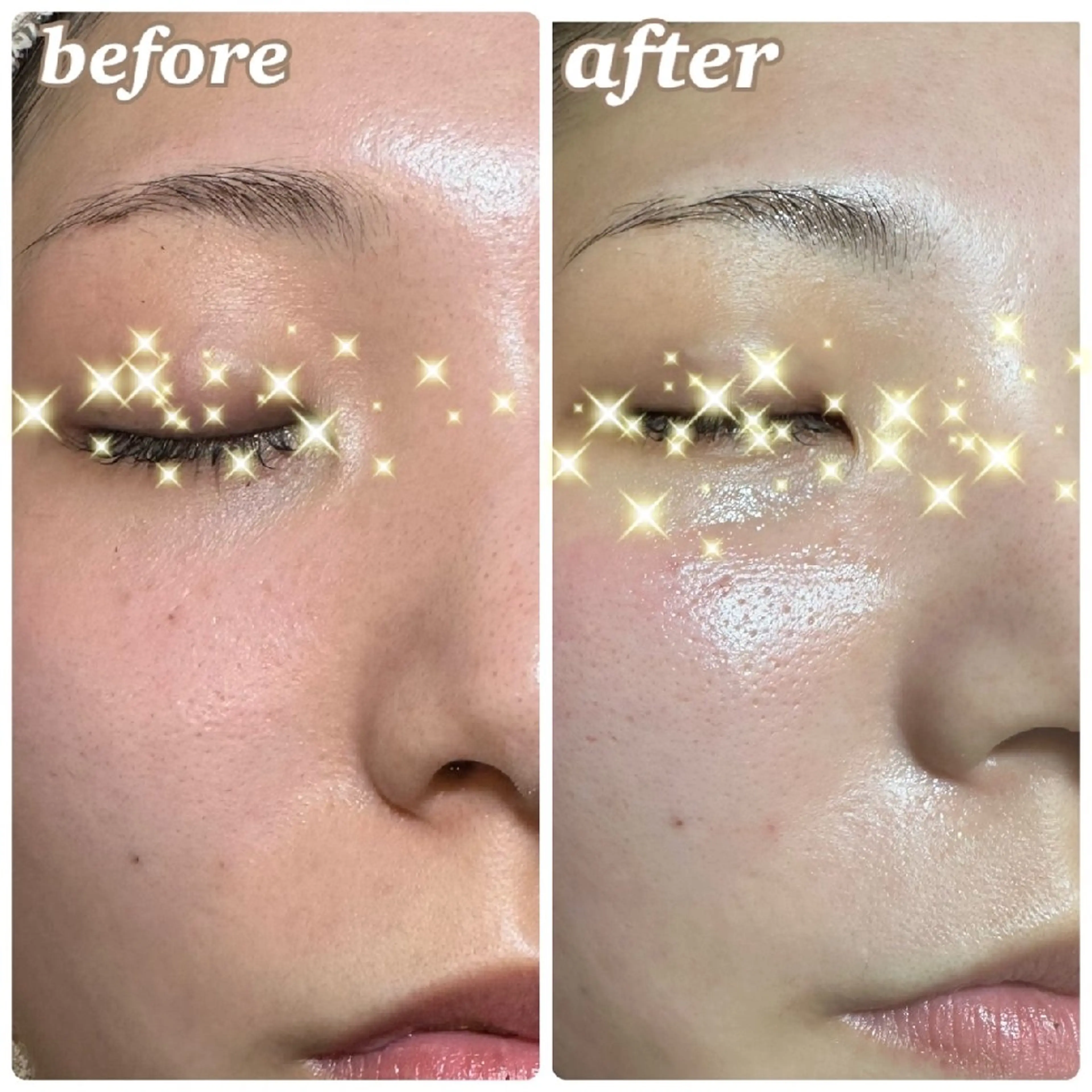 【メンズ&レディース】一度ですっきり☆フェイシャルWAXの写真
