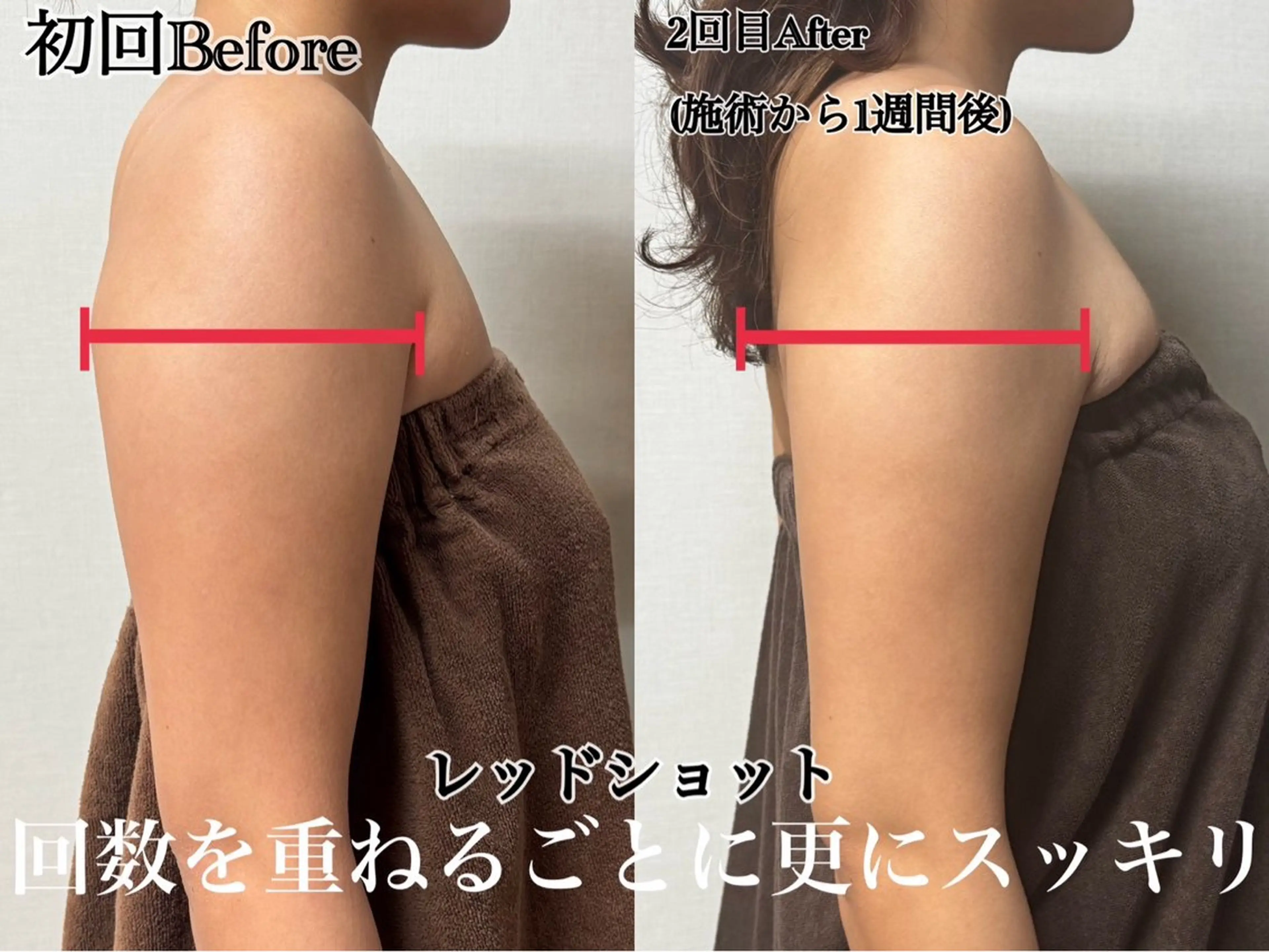 六本木脱毛andS さおりのエステ・リラクイメージ