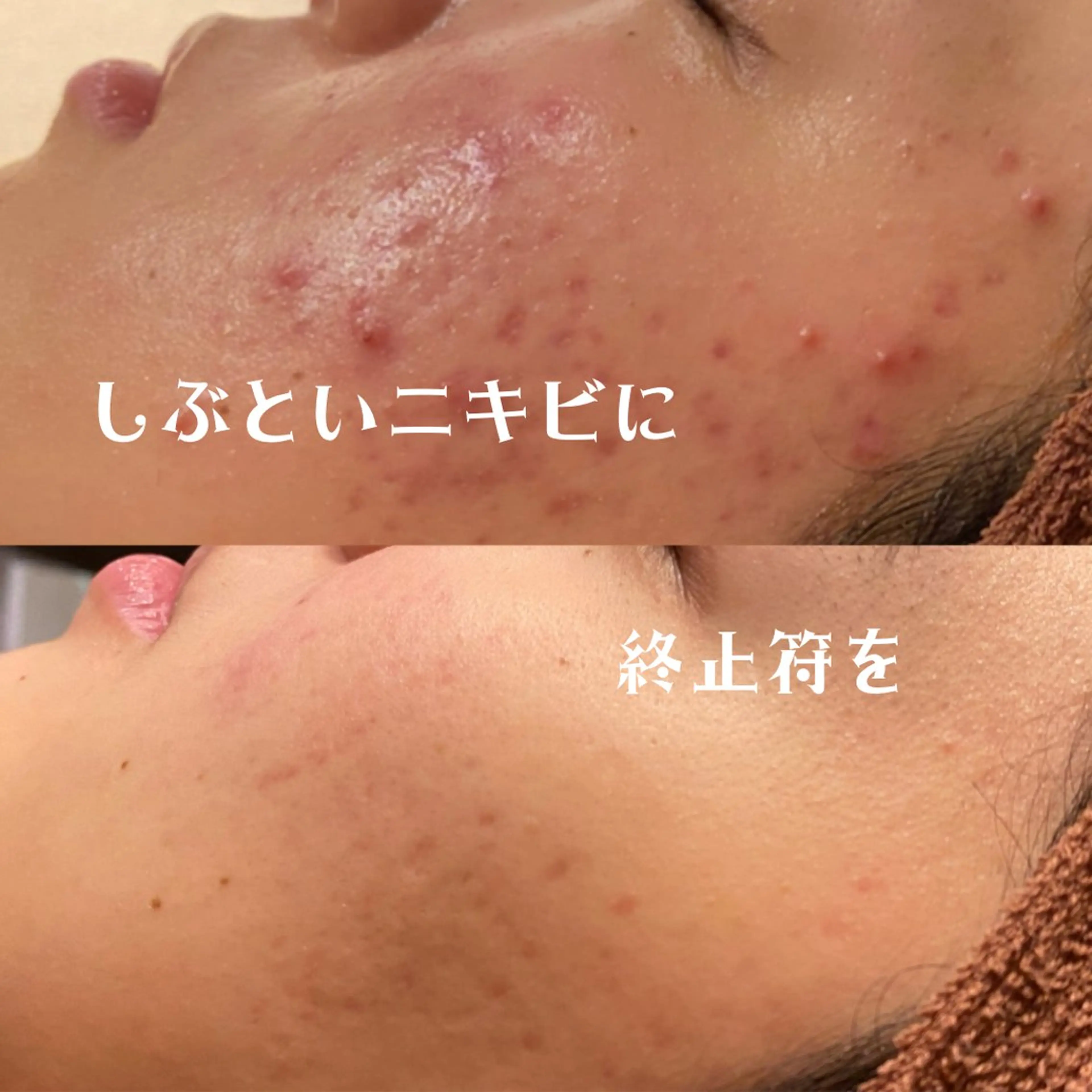 【美肌+マッサージ💆♀️】よくばりお得クーポン🉐✨お肌モチモチ温熱パックまで⭐️の写真