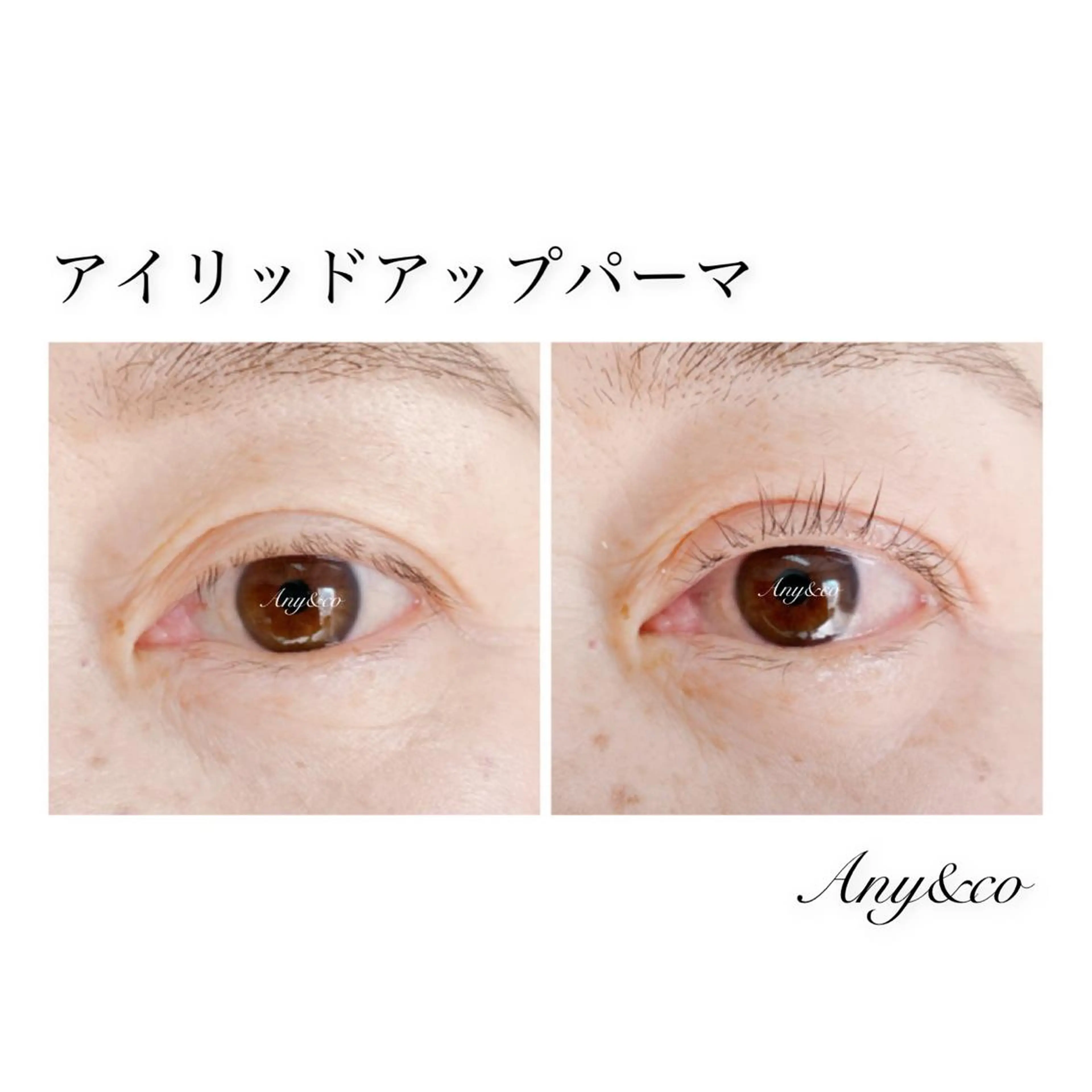 マツエク・マツパ アイリッドアップパーマ Any&co 【エニコ】のマツエク・マツパデザイン