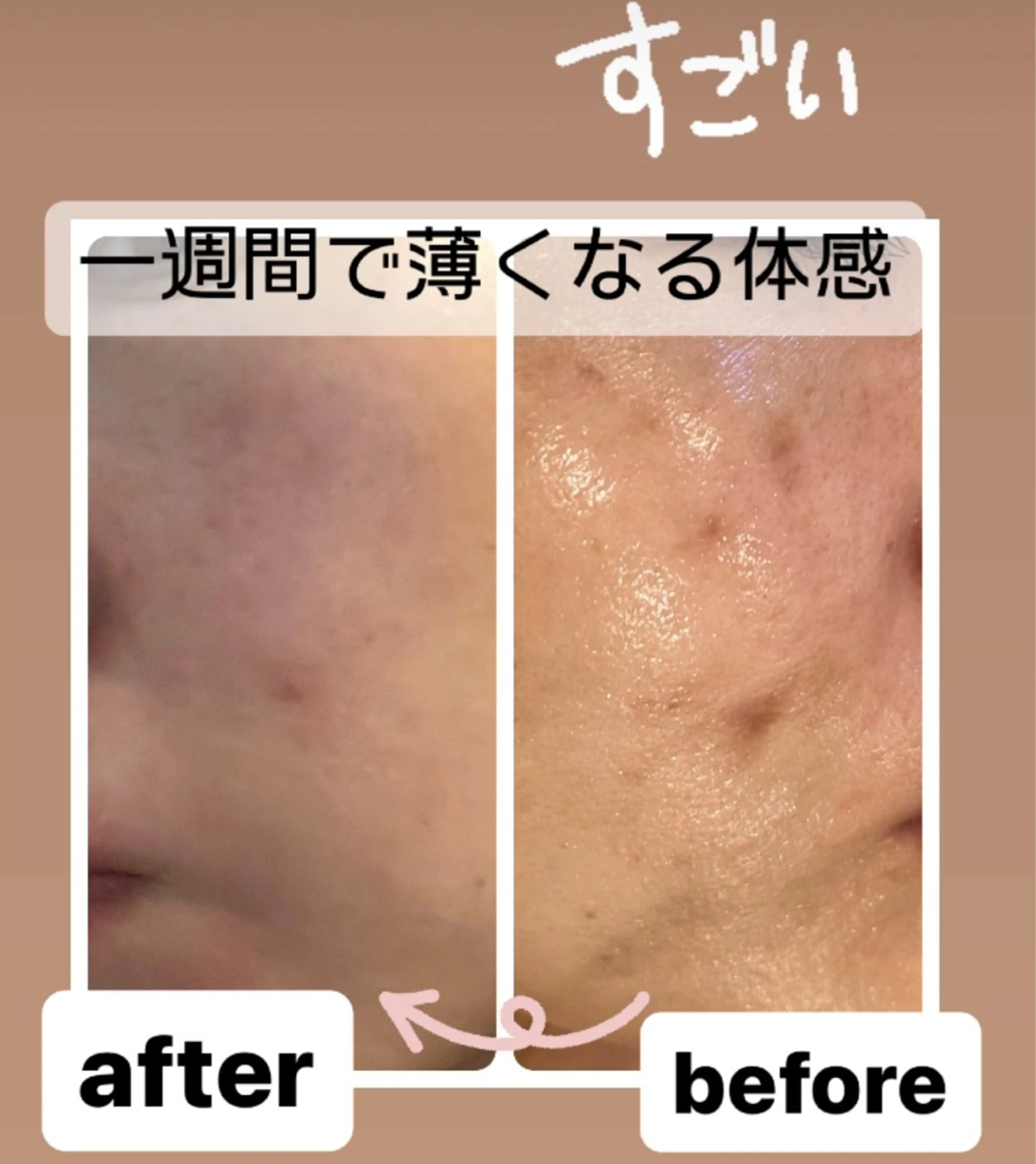 🅖🅤🅩🅔🅛 salonのエステ・リラクイメージ