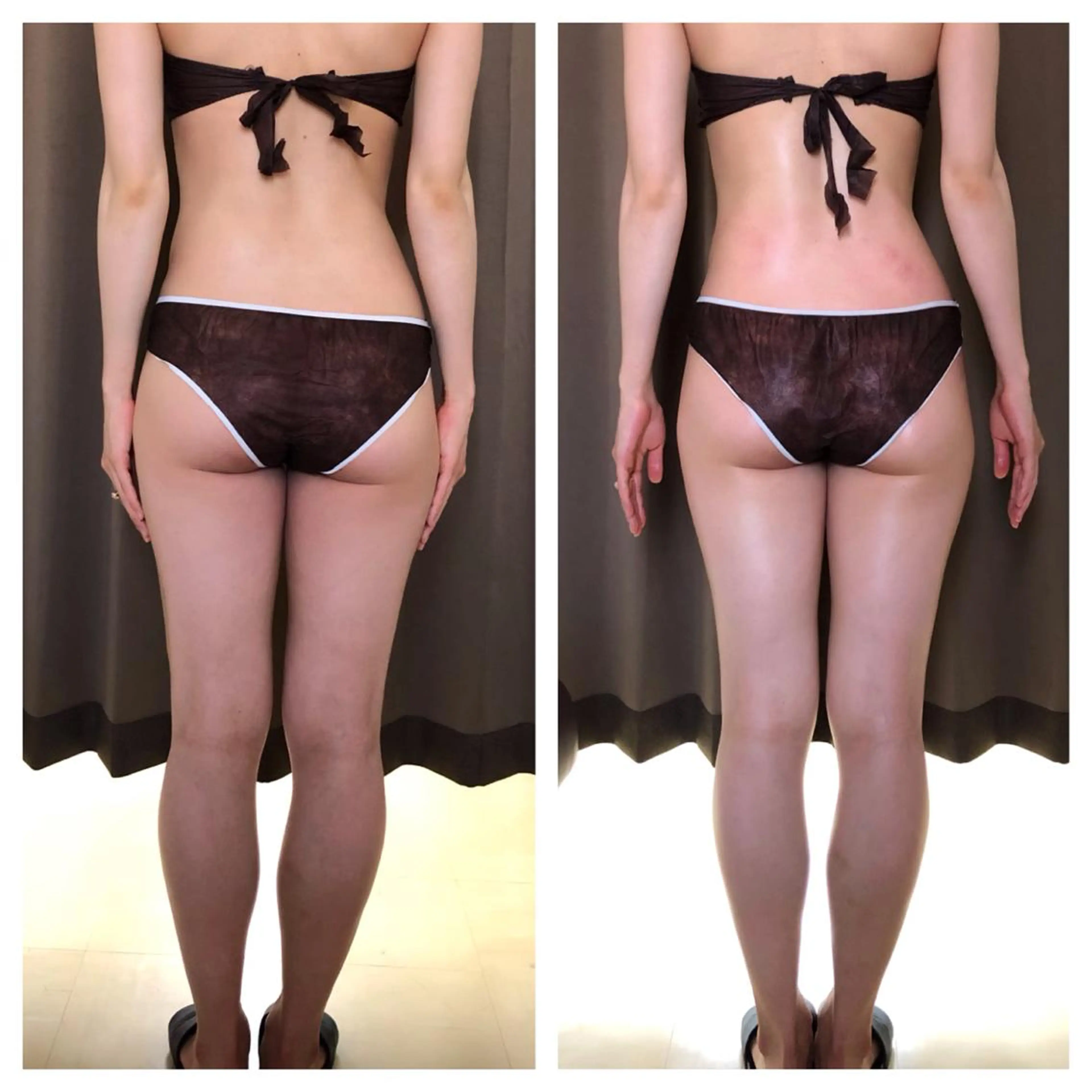 小顔・痩身専門店 Sunao所属・小顔.足痩せ整体 痩身天六Sunaoのその他イメージ