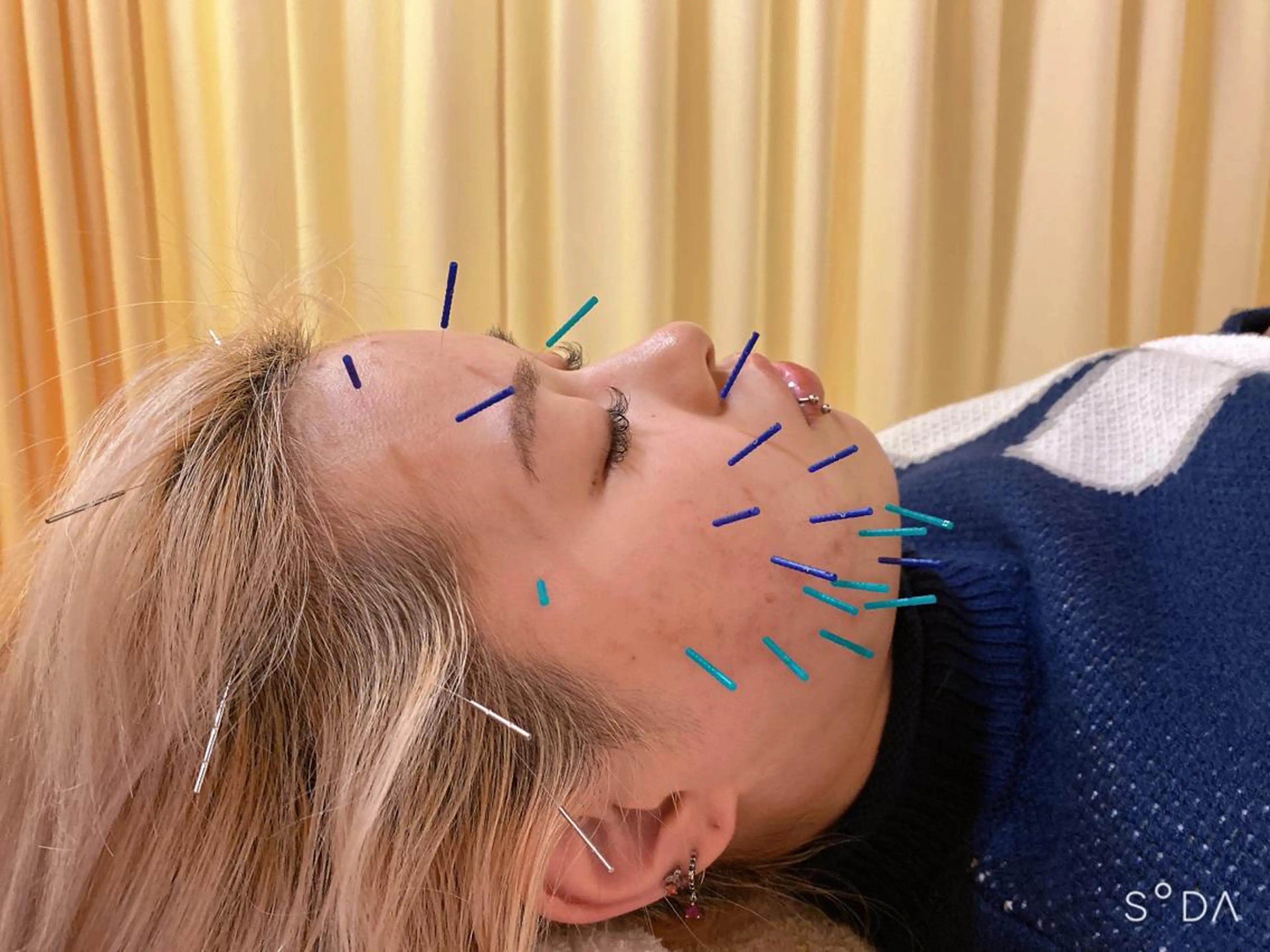 鍼灸サロン BBB3のその他イメージ