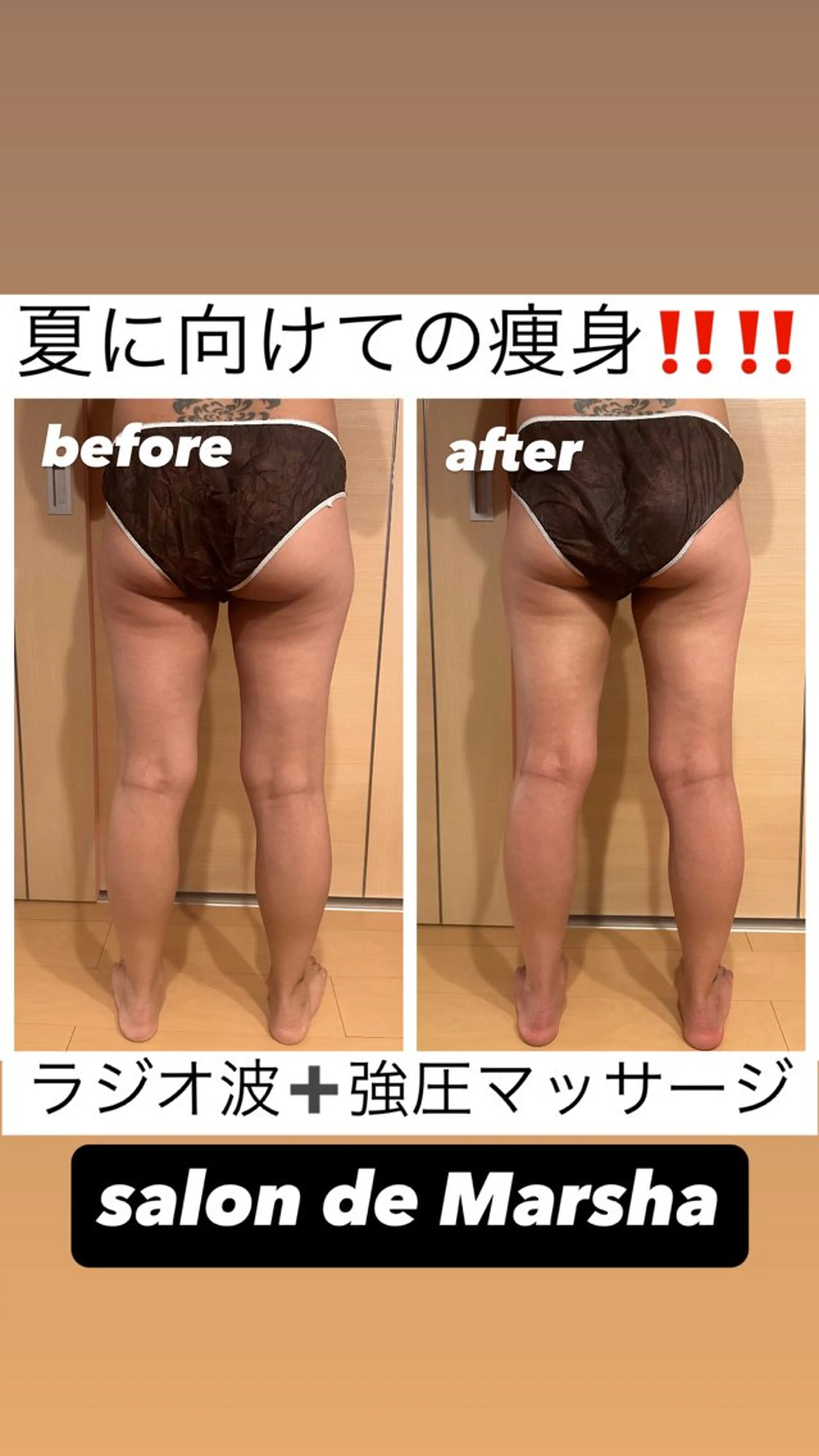 【よもぎ蒸し付き】気になる上半身or下半身　ラジオ波＋強圧マッサージ（30分）お得な¥9,000→¥6,800！の写真