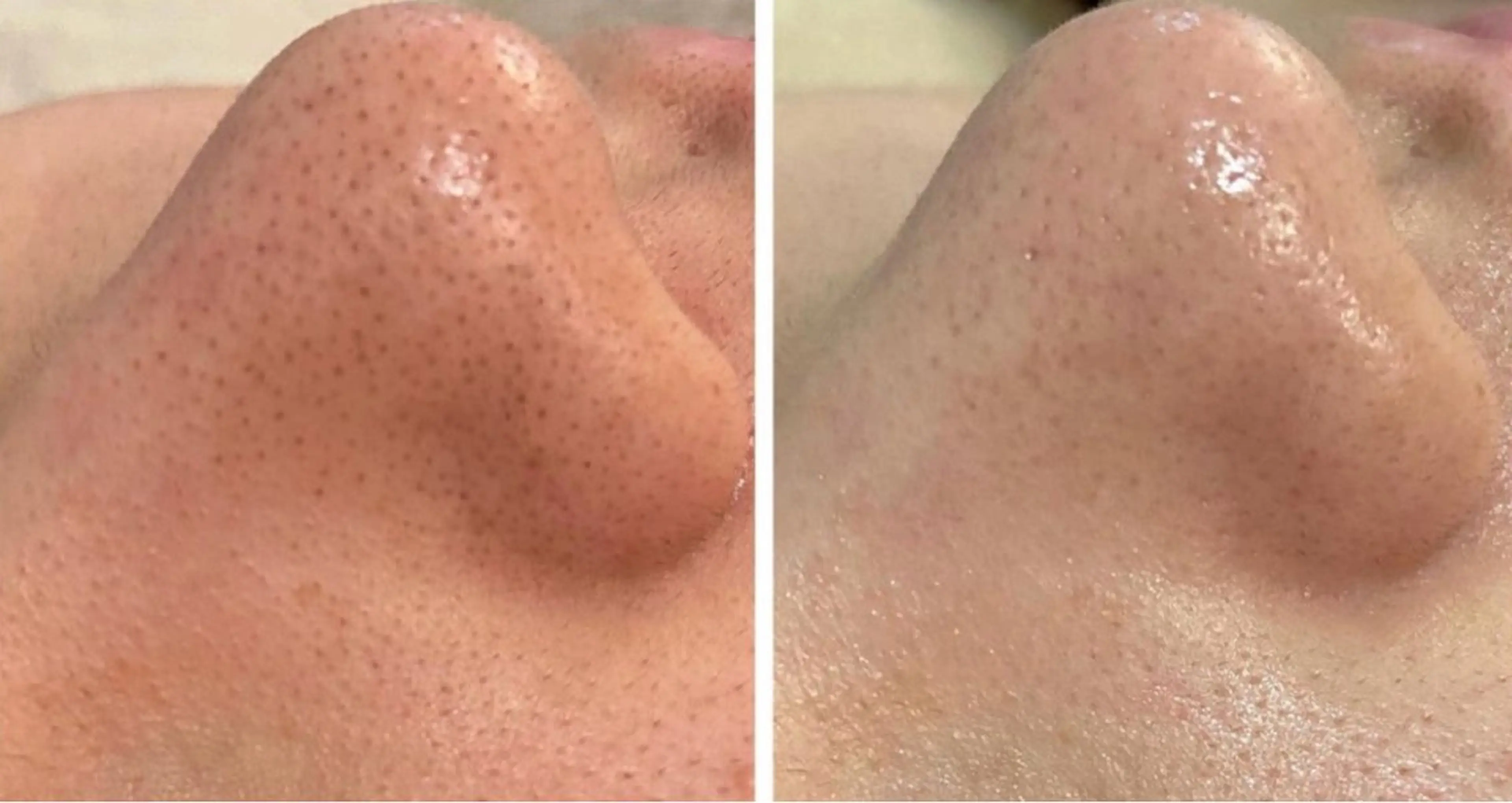 立体小顔×艶肌×美ボ ディ似合わせ施術 岡のエステ・リラクイメージ