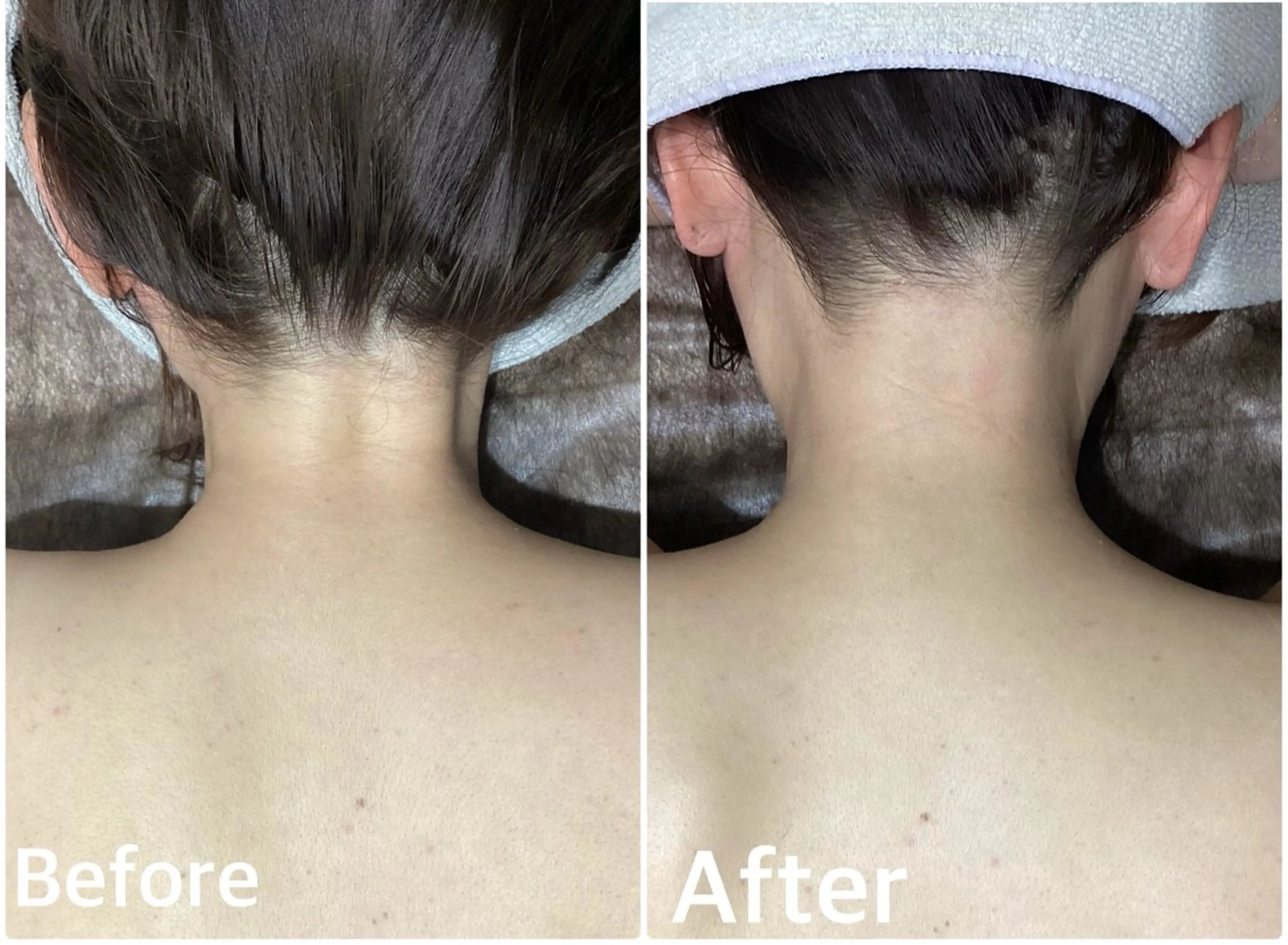 脱毛 Pullulant EstheKyotoのエステ・リラクイメージ