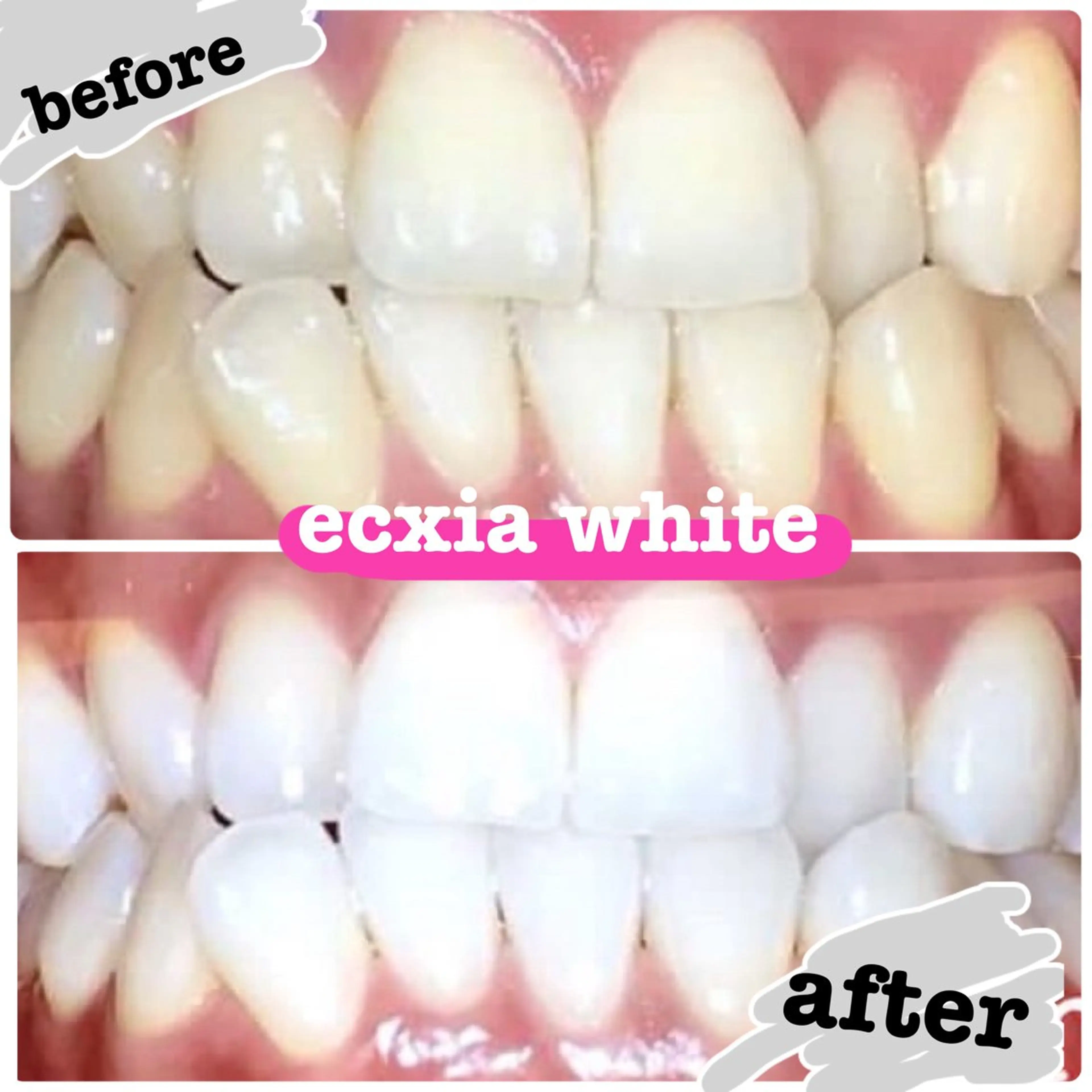 【定額★通い放題】セルフホワイトニング11,000円/月の写真