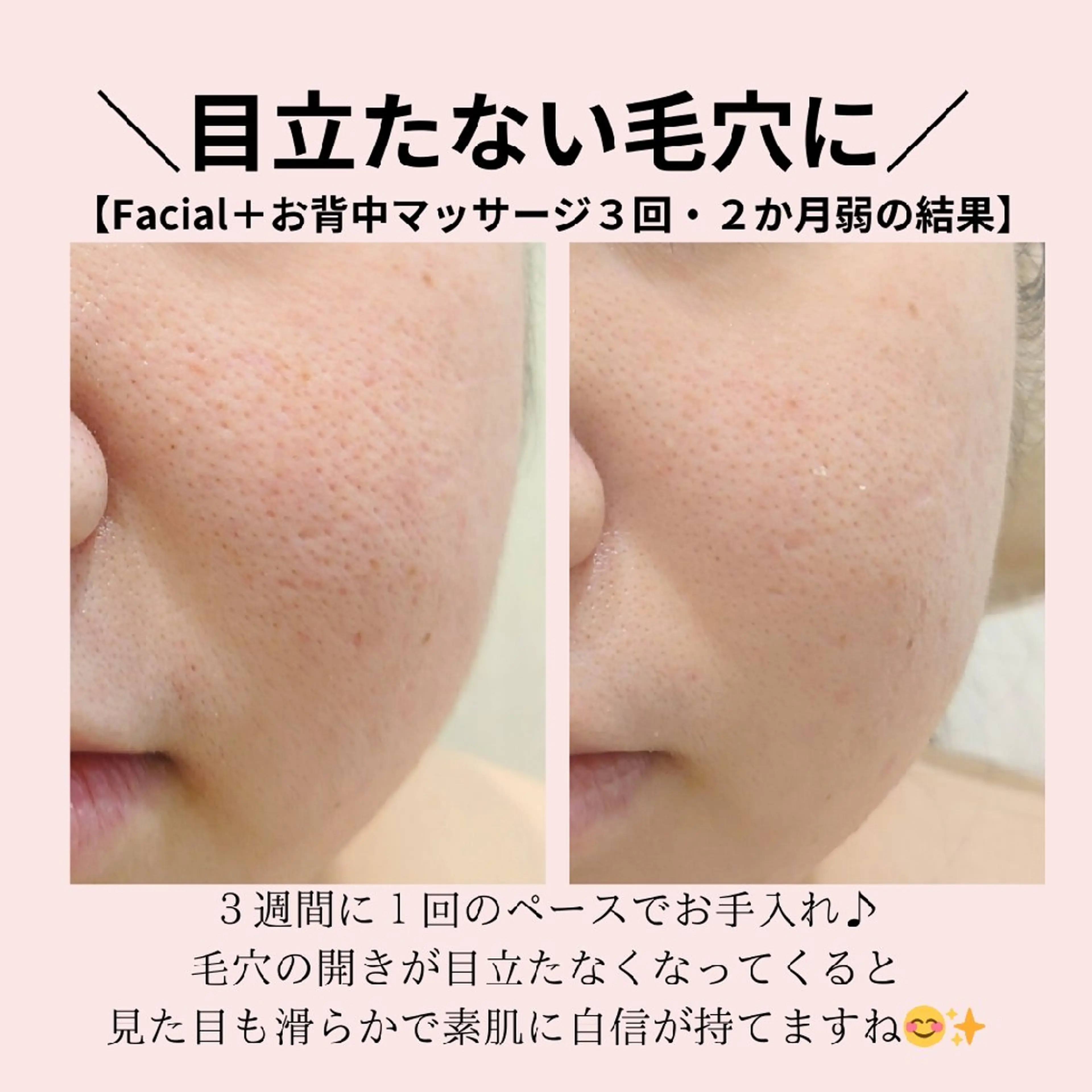 エステ PRETTIEST SHINE所属・フェイシャル/ボディ /ブライダル山田浩子のエステ・リラクイメージ