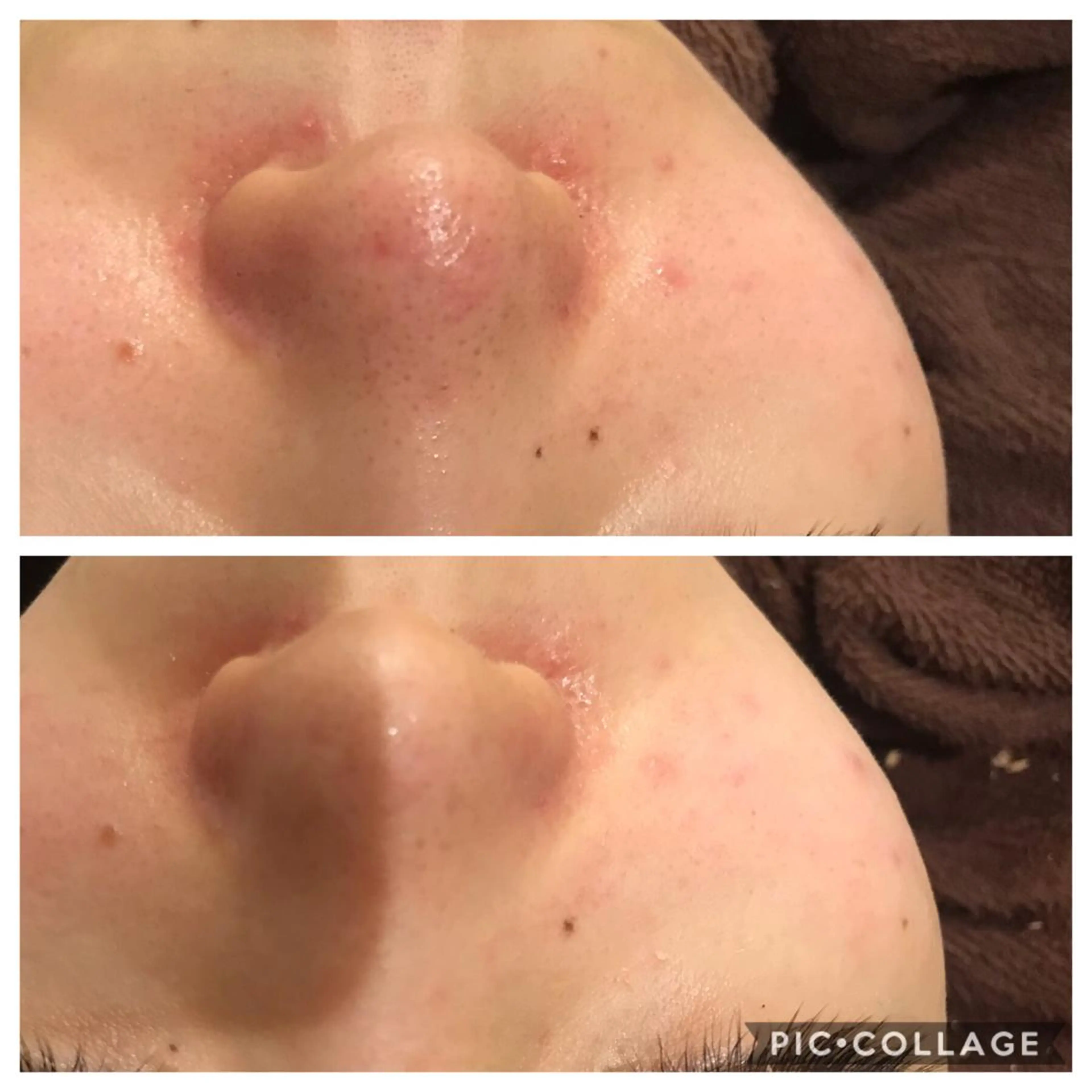 セミロング カラー パーマ ヘアアレンジ メンズ キッズ ネイル マツエク・マツパ 金の糸脱毛 産毛ケア専門のエステ・リラクイメージ