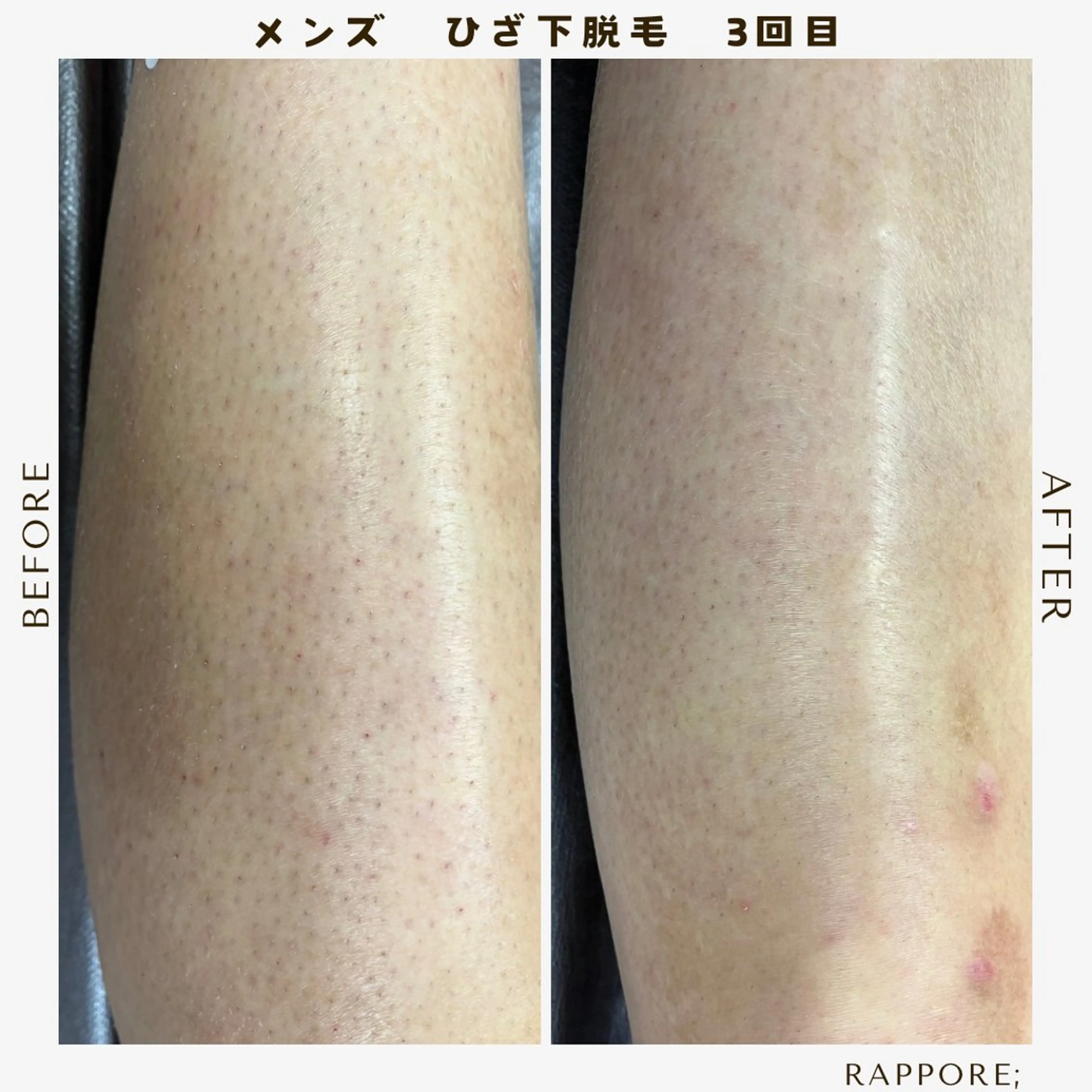 メンズ Rappore; 心斎橋　みずきのエステ・リラクイメージ