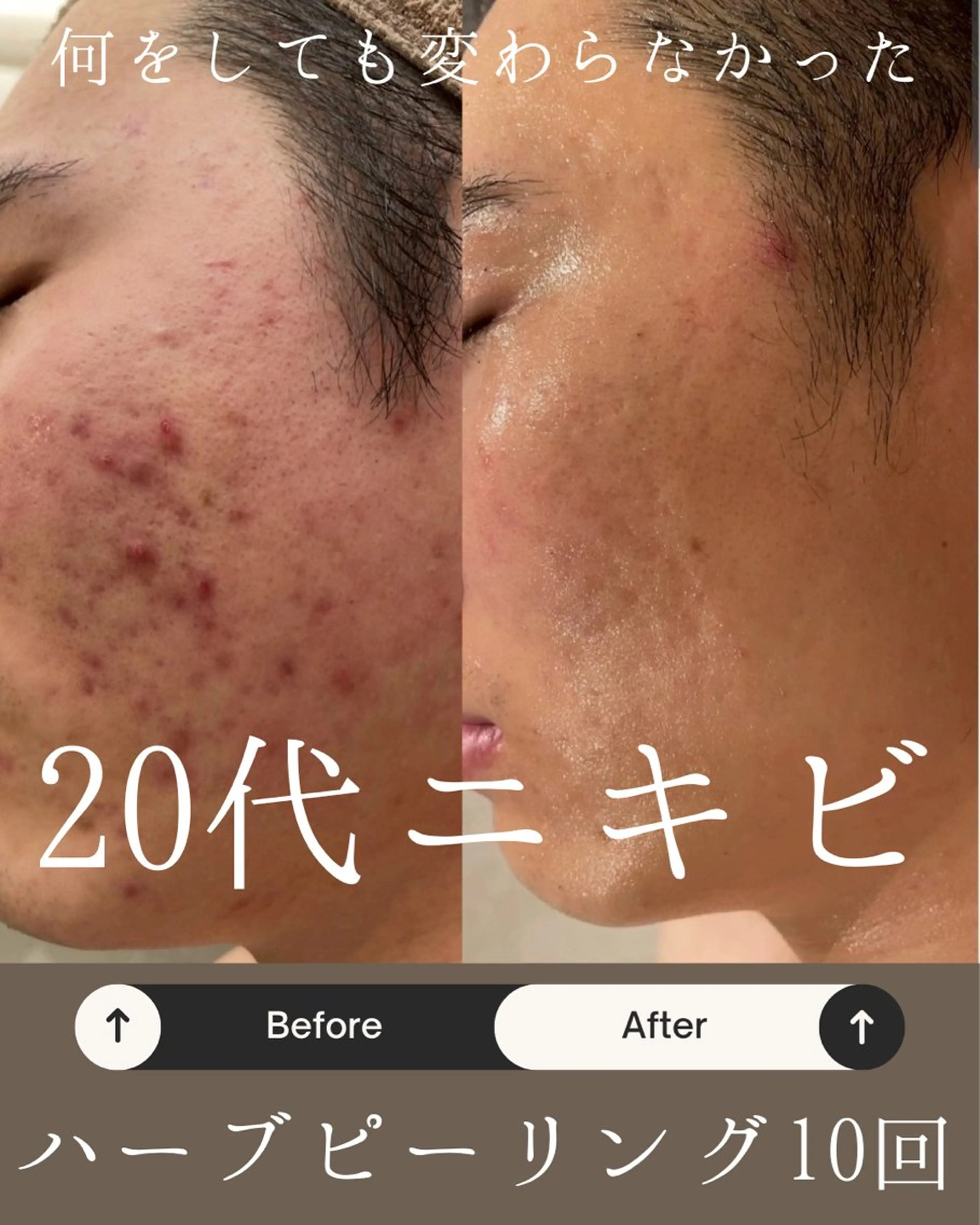 Anpawman  【ハーブピーリング専門店】所属・Anpawman ハーブピーリング専門のエステ・リラクイメージ