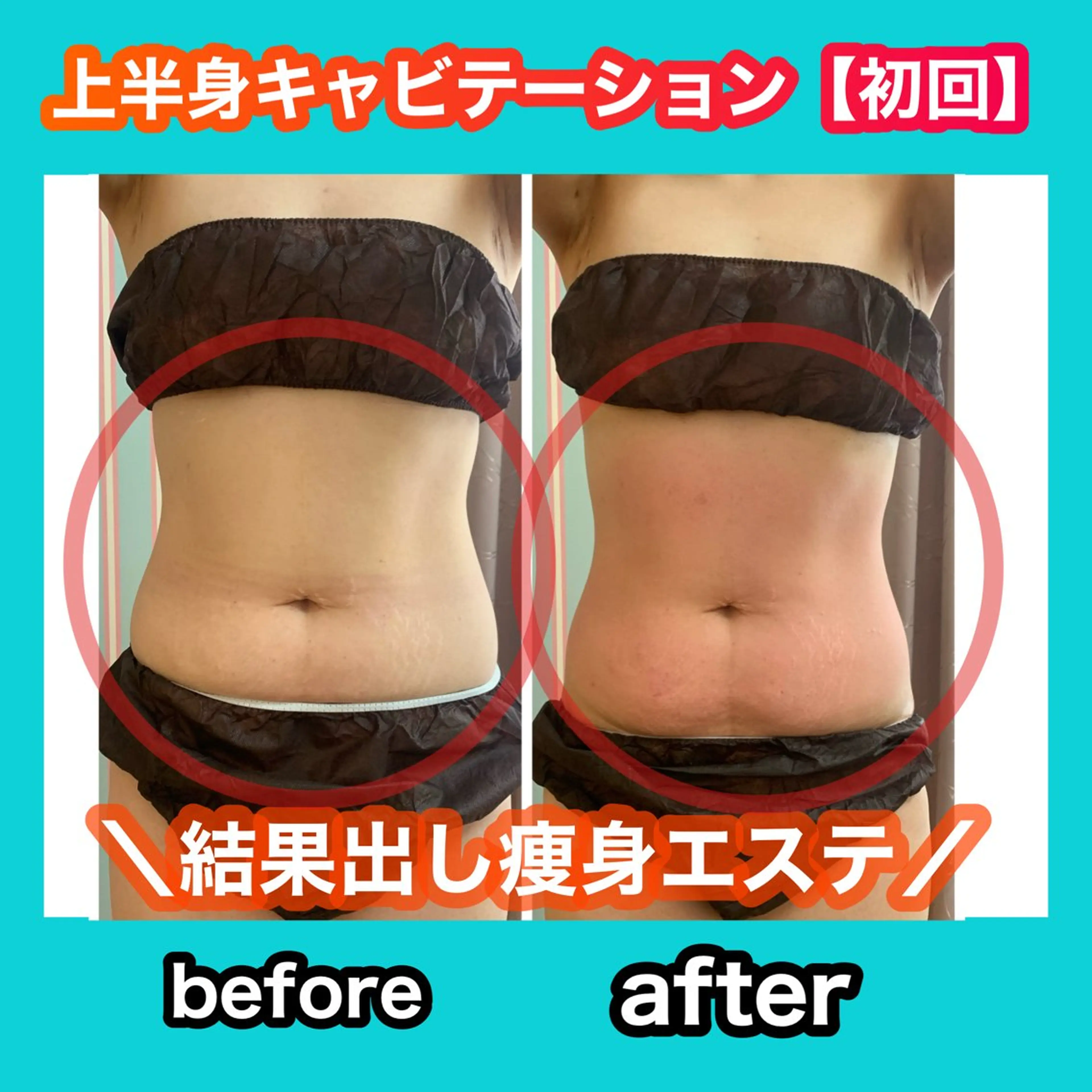 エステ リラク 痩身/脱毛/ネイル HARUKAのエステ・リラクイメージ