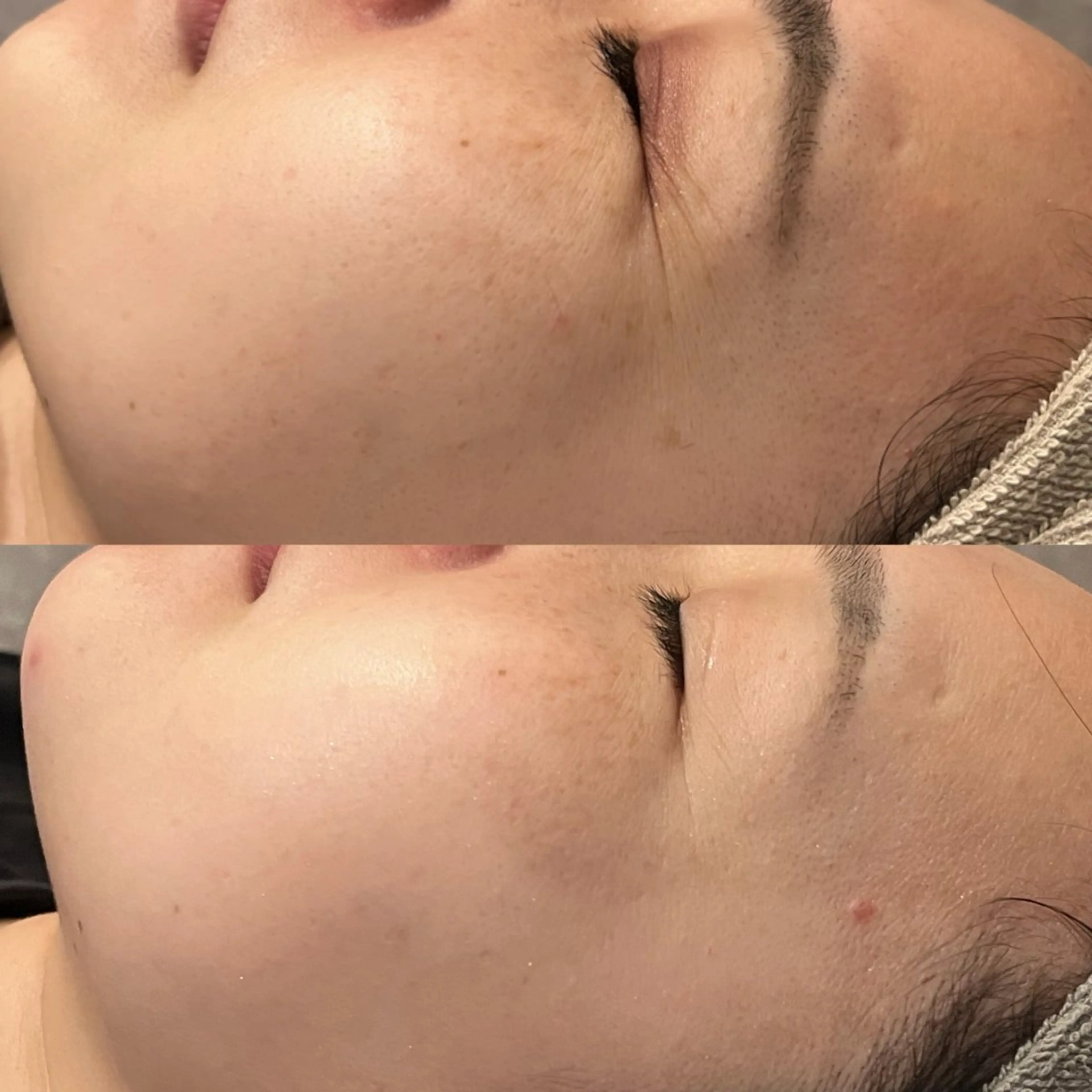 エステ yellow.所属・yellow💛【 脱毛&フェイシャル】のエステ・リラクイメージ