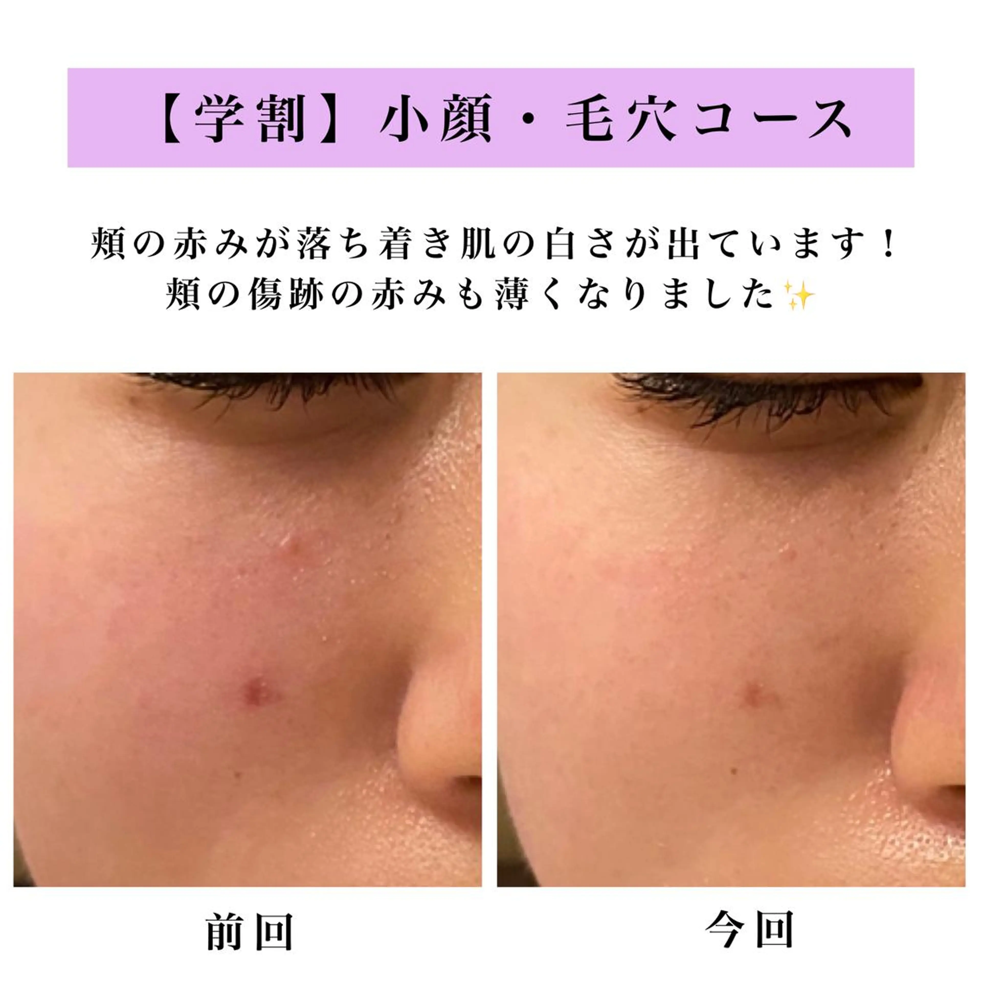 Bellesthe （ベルエステ）のエステ・リラクイメージ