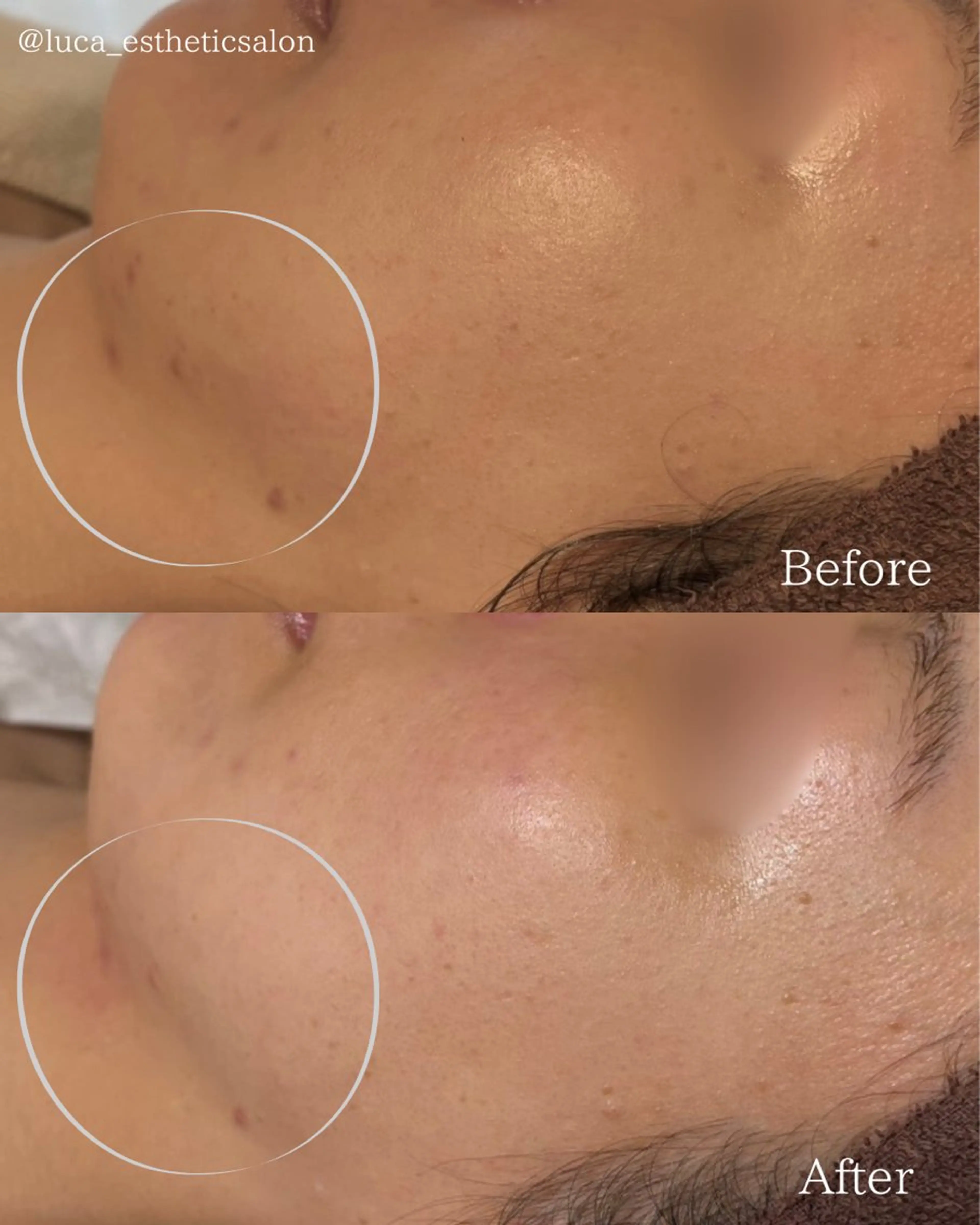 エステ Luca 痩身• 疲労改善×韓国肌管理のエステ・リラクイメージ