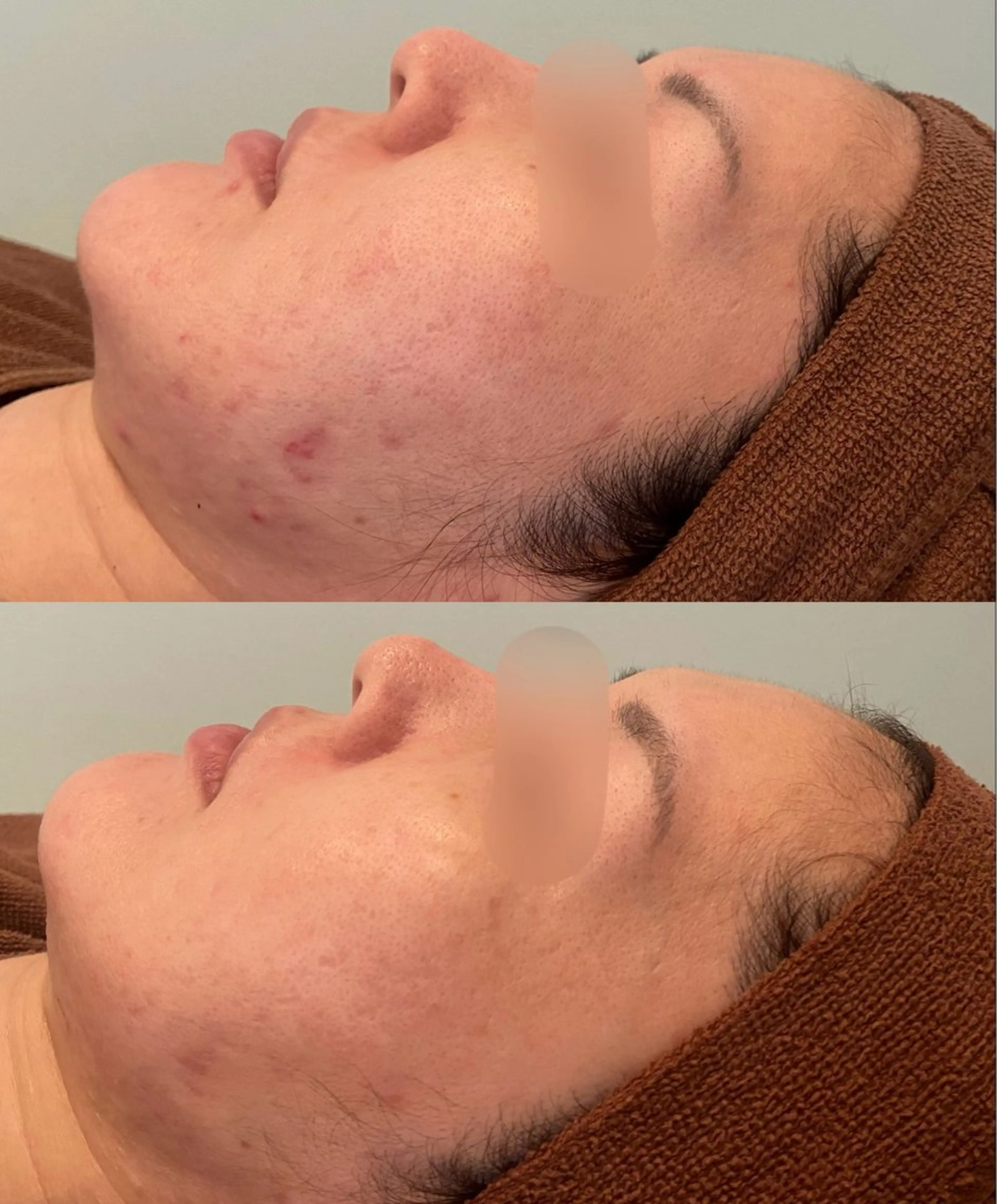 エステ ハーブピーリング専門 BIOPLUS＋川崎のエステ・リラクイメージ