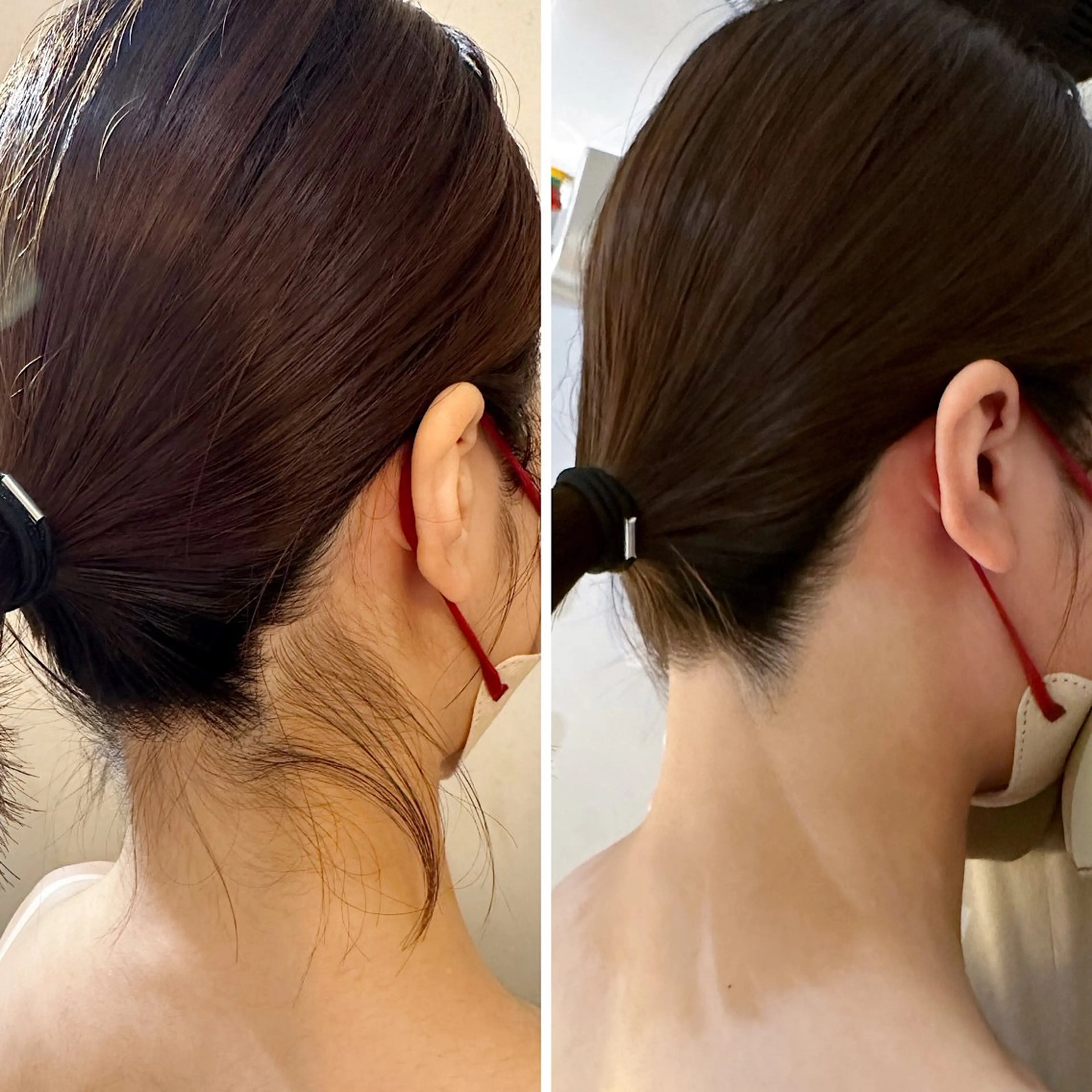 脱毛 うなじ脱毛/美肌脱毛 LABELのエステ・リラクイメージ