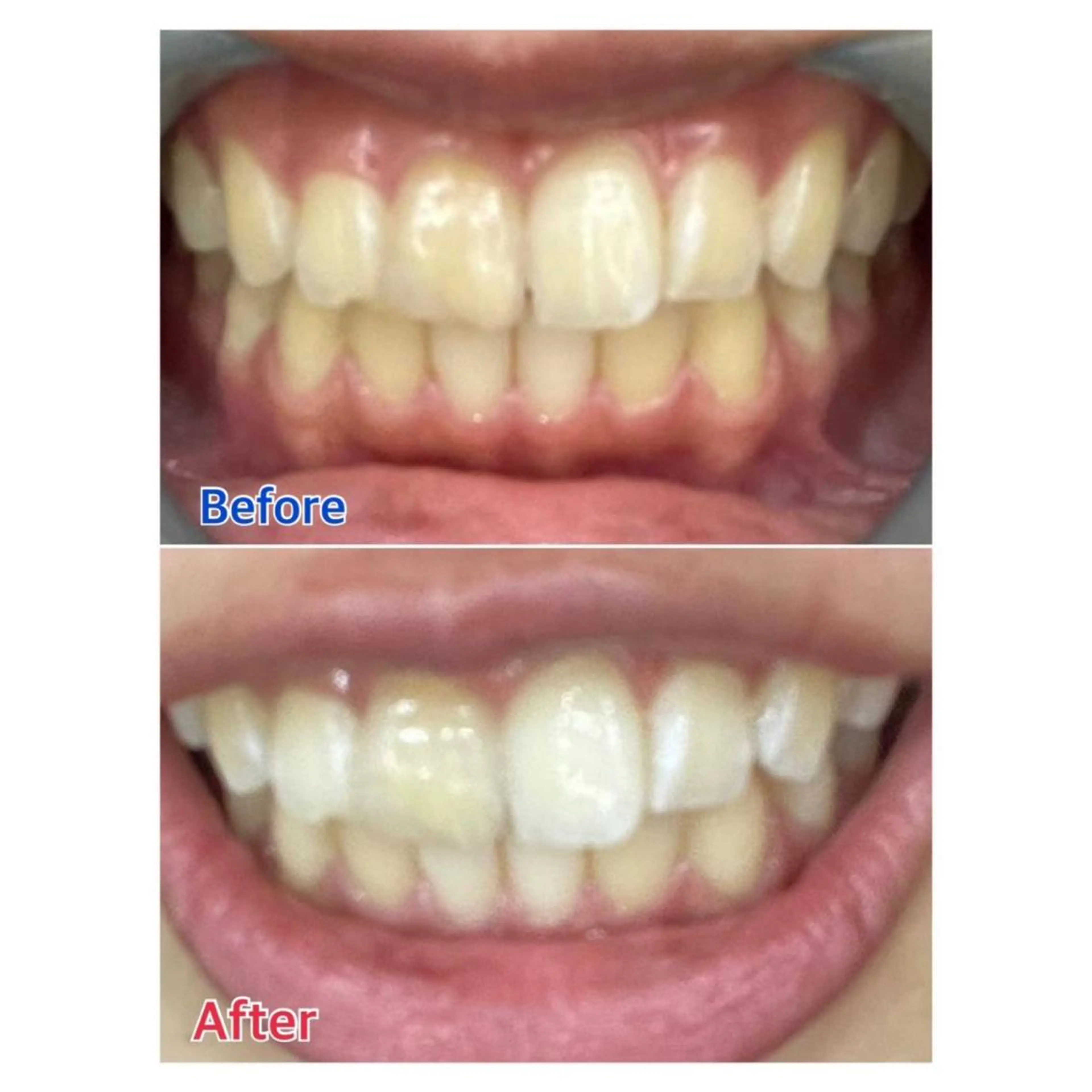 Melty 輝のその他イメージ