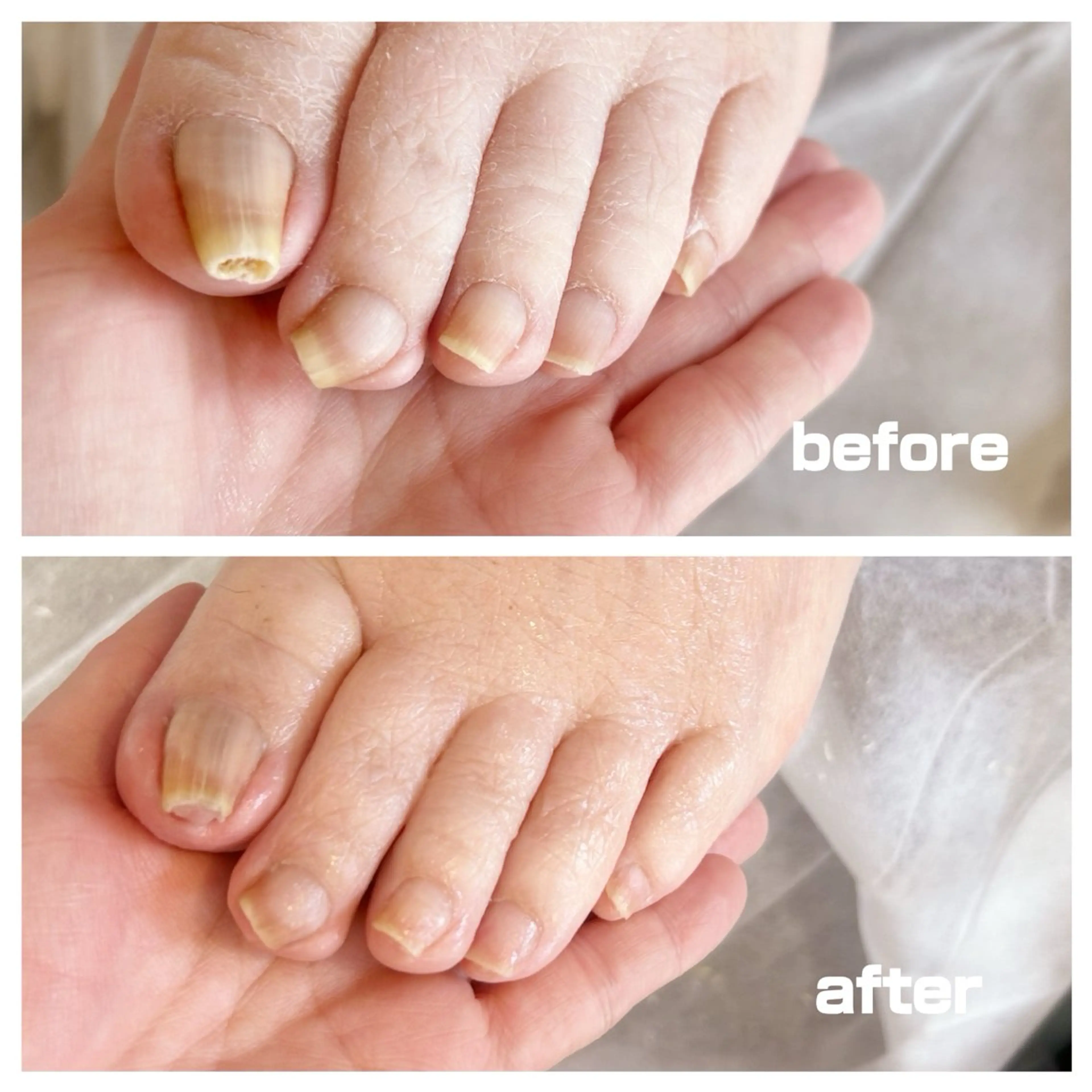 その他 巻き爪フットケアサロンKotori所属・フットケアサロン Kotoriのその他イメージ