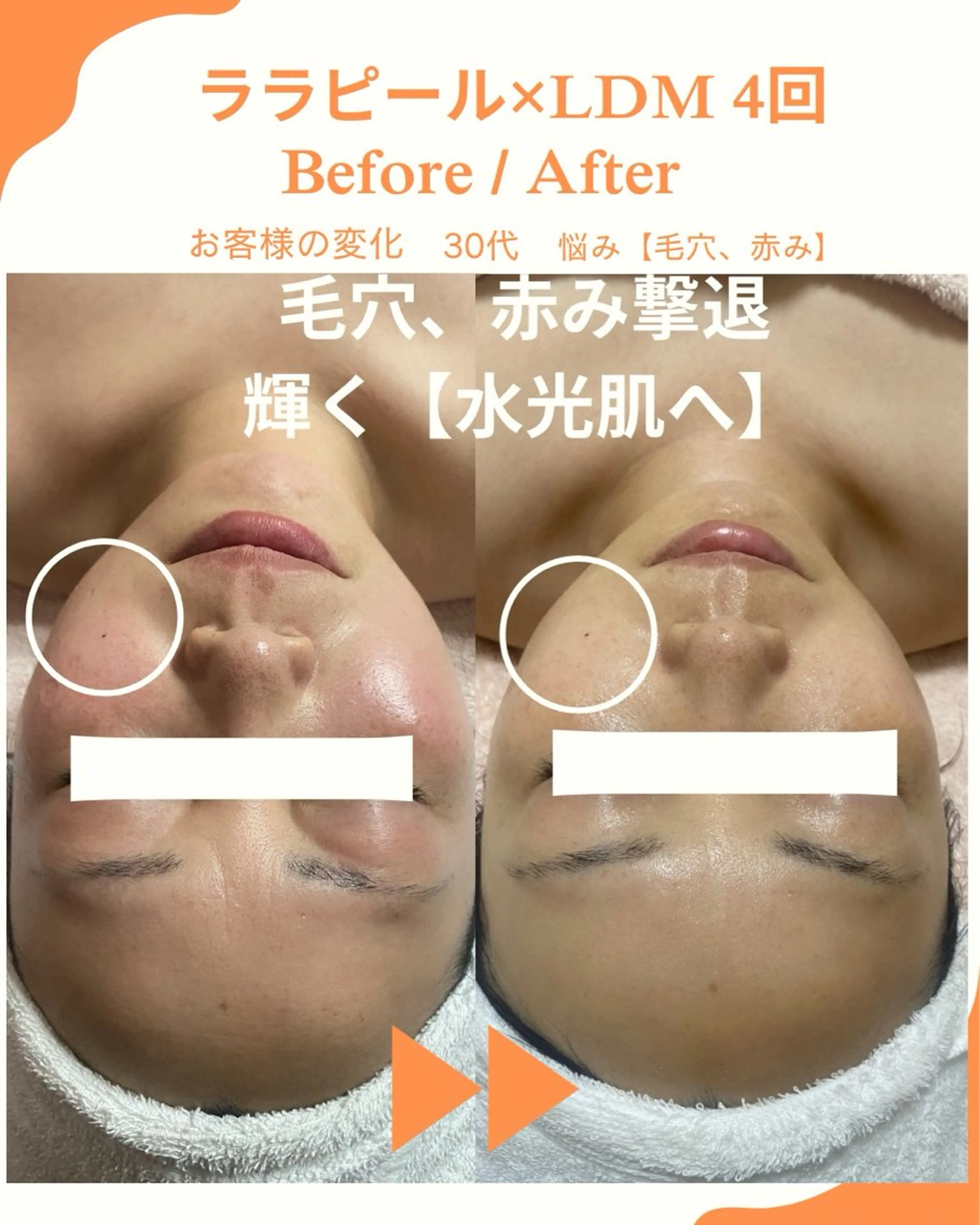 エステ 小西 綾香のエステ・リラクイメージ