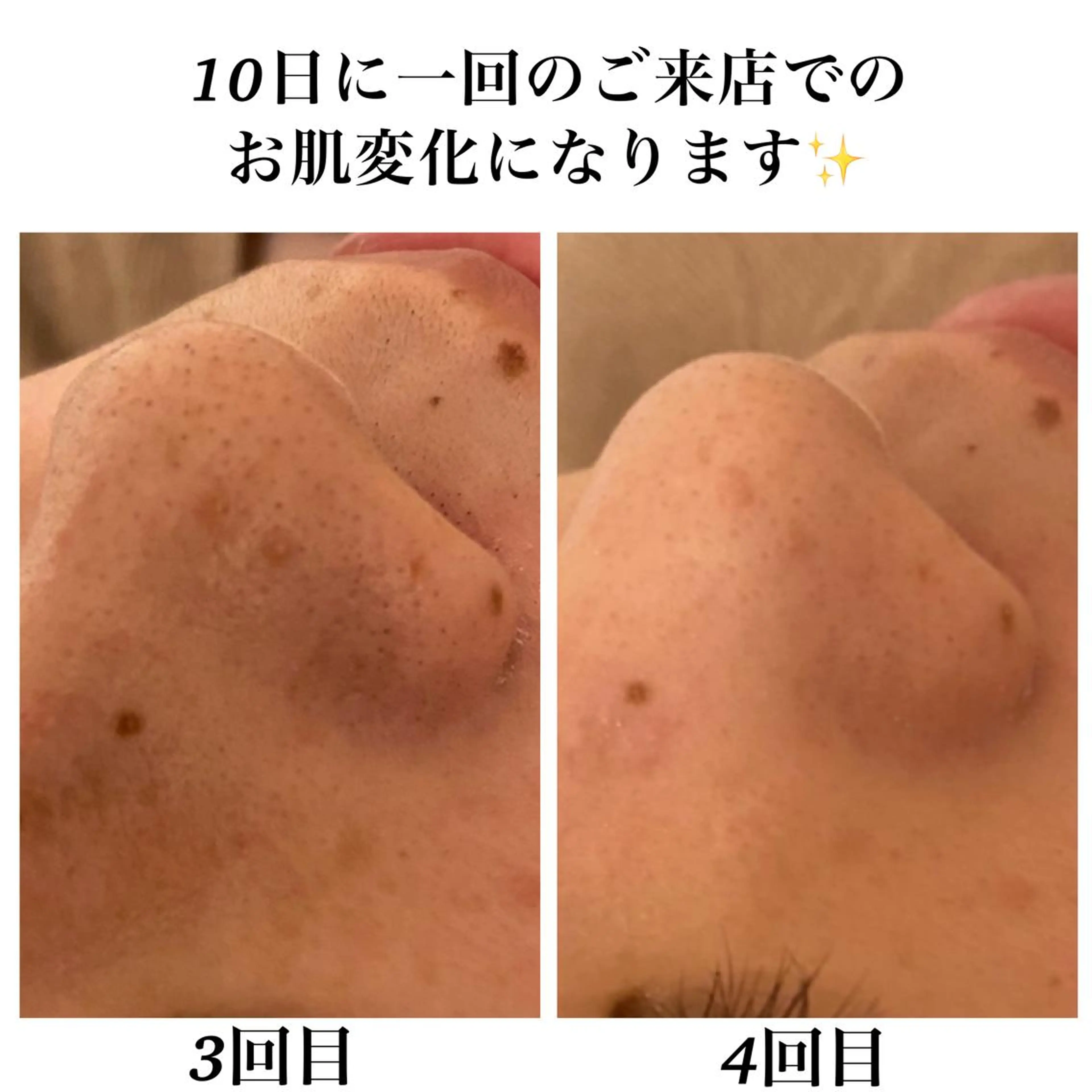 エステ リラク Bellesthe (ベルエステ)のエステ・リラクイメージ