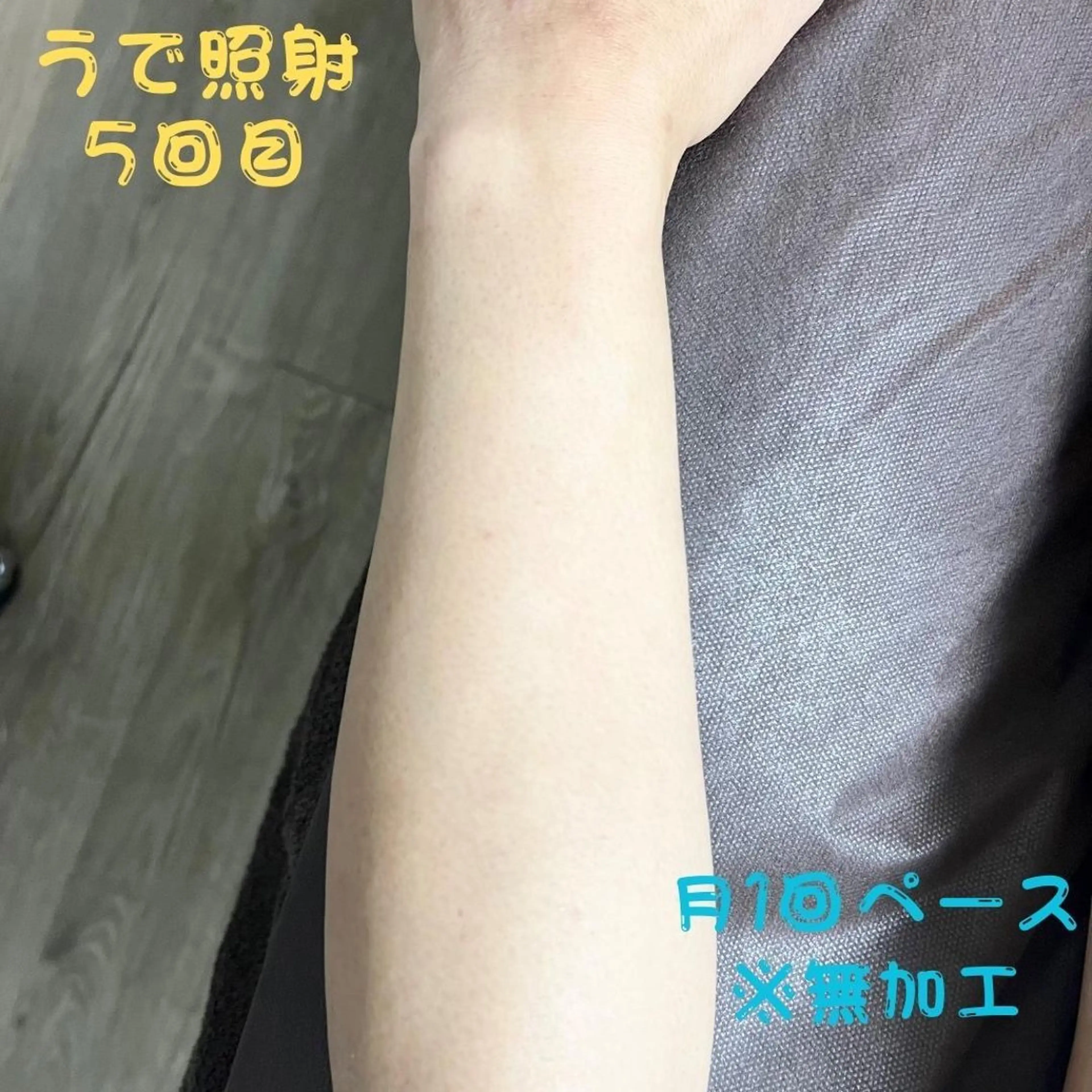 メンズ キッズ 脱毛 メンズ脱毛フェリッセ /男女🆗キッズ🆗のエステ・リラクイメージ