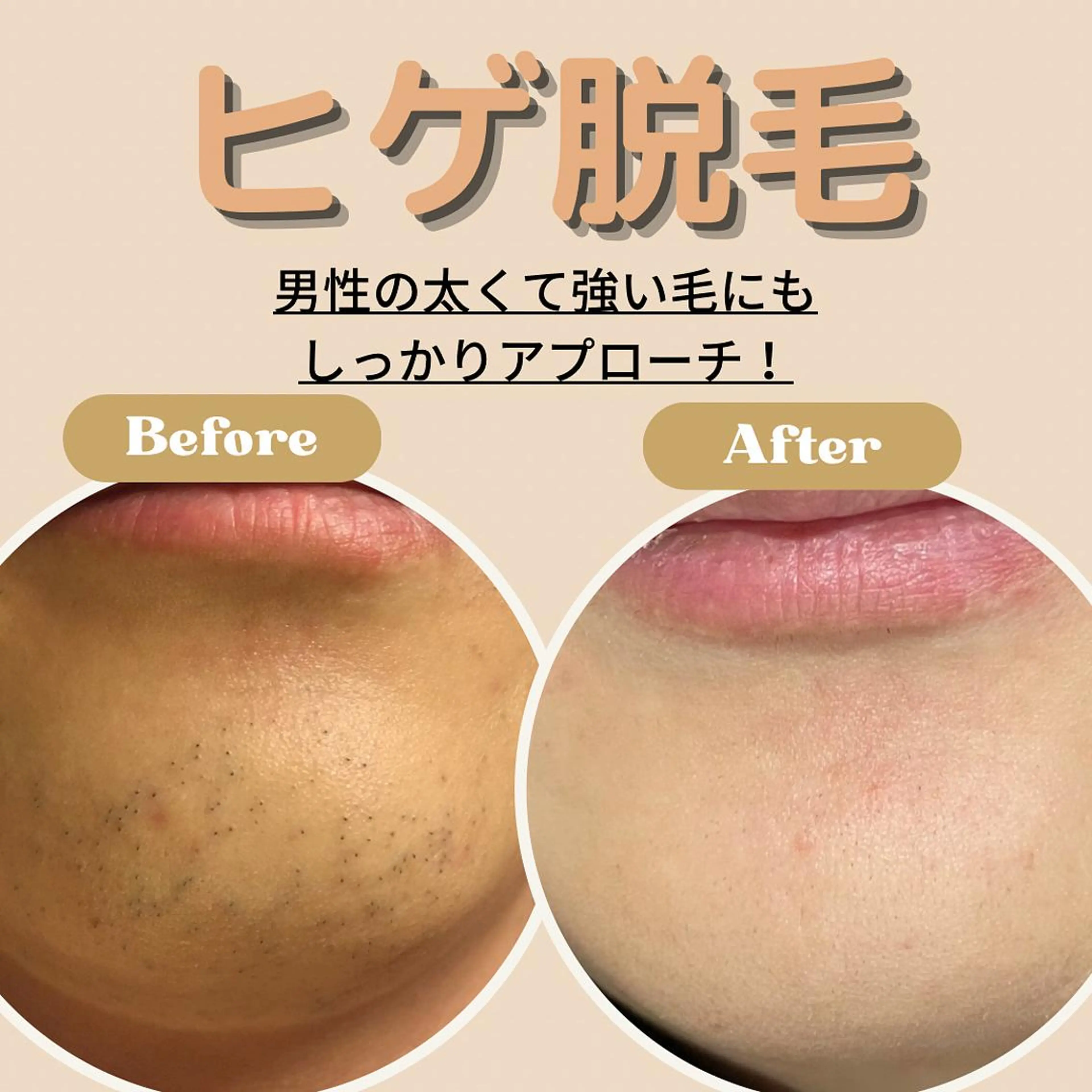 メンズ メンズ脱毛サロン 髭職人VIO(ヴィオ)所属・サロンVio梅田店 平山のエステ・リラクイメージ