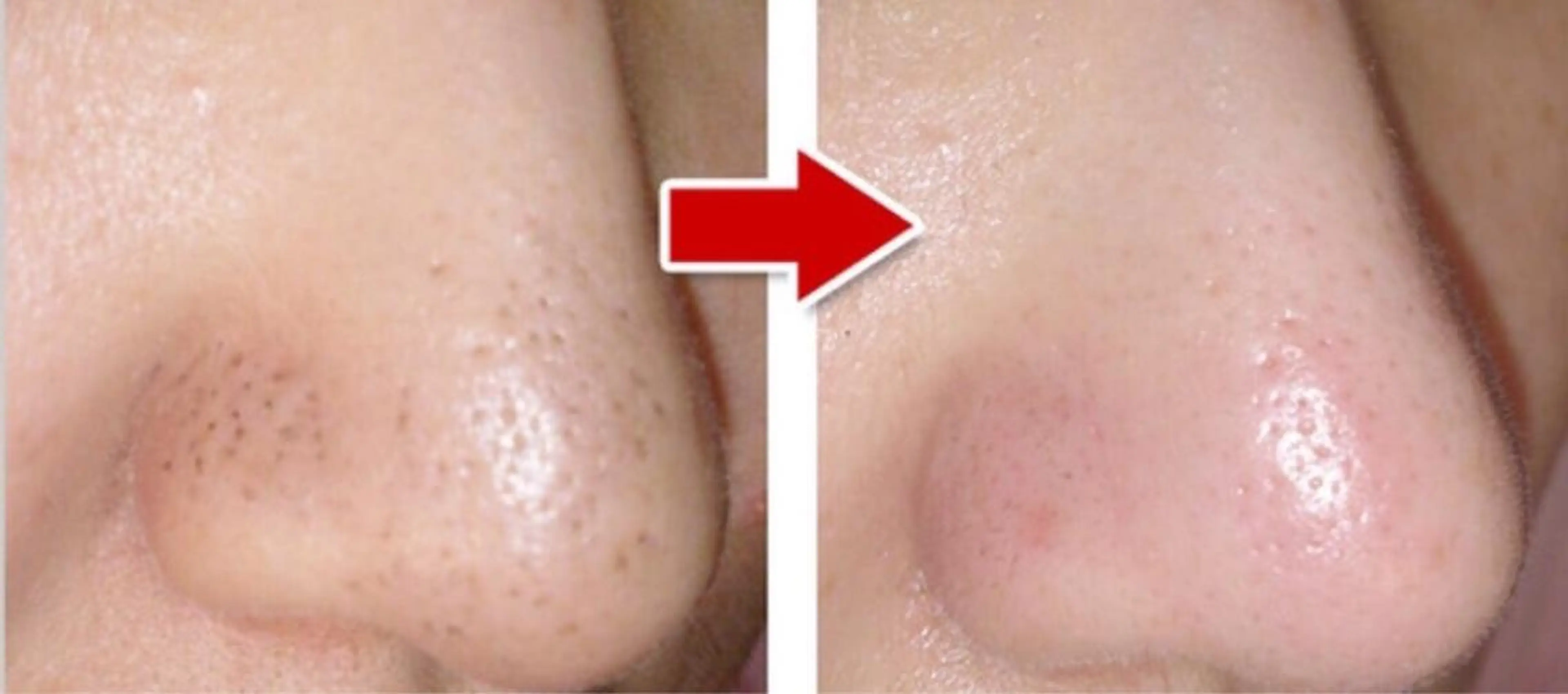 エステ リラク 🏳️‍🌈 CHIYAKAのエステ・リラクイメージ