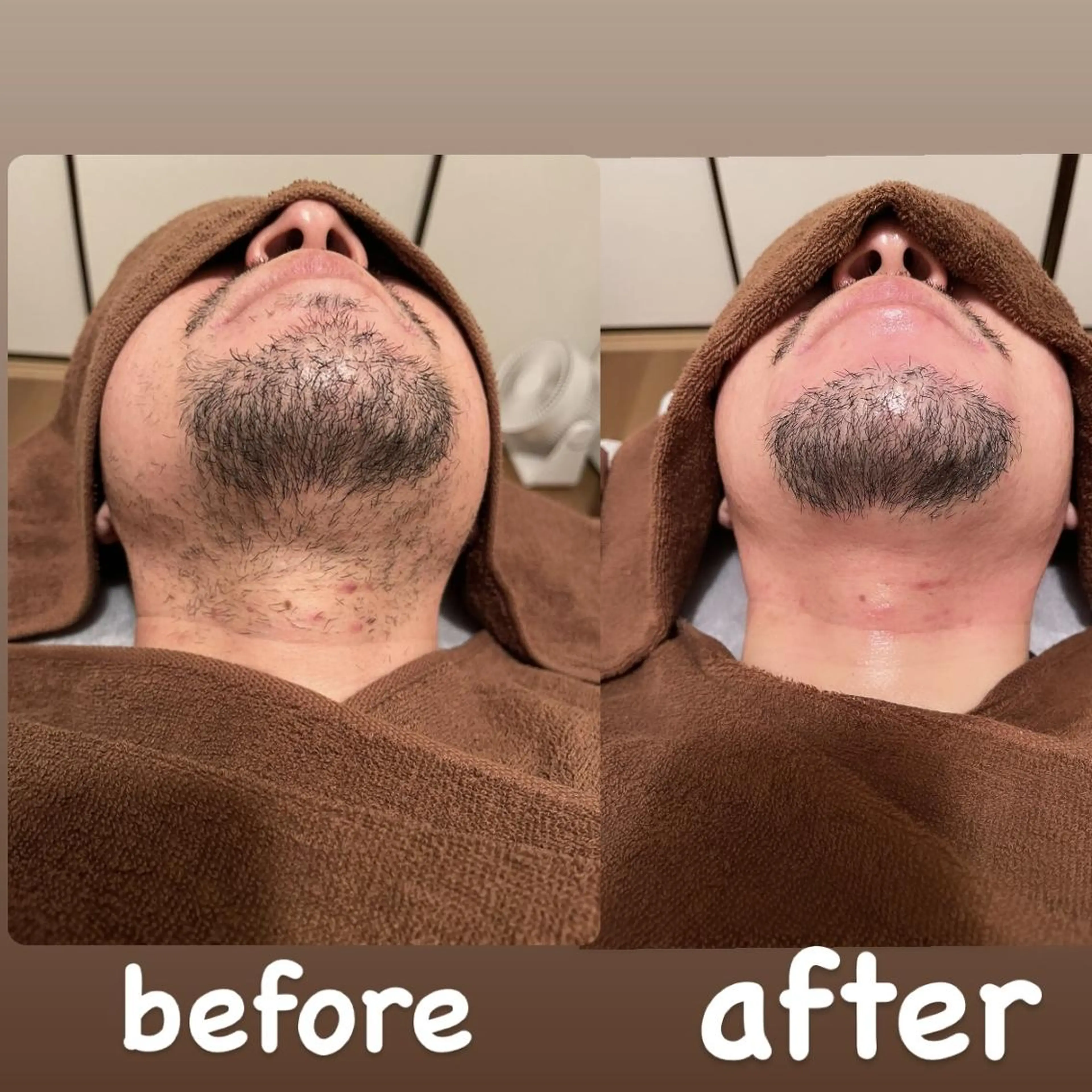 メンズ眉毛ITSUK Iメンズ専門　新宿の眉毛・アイブロウイメージ